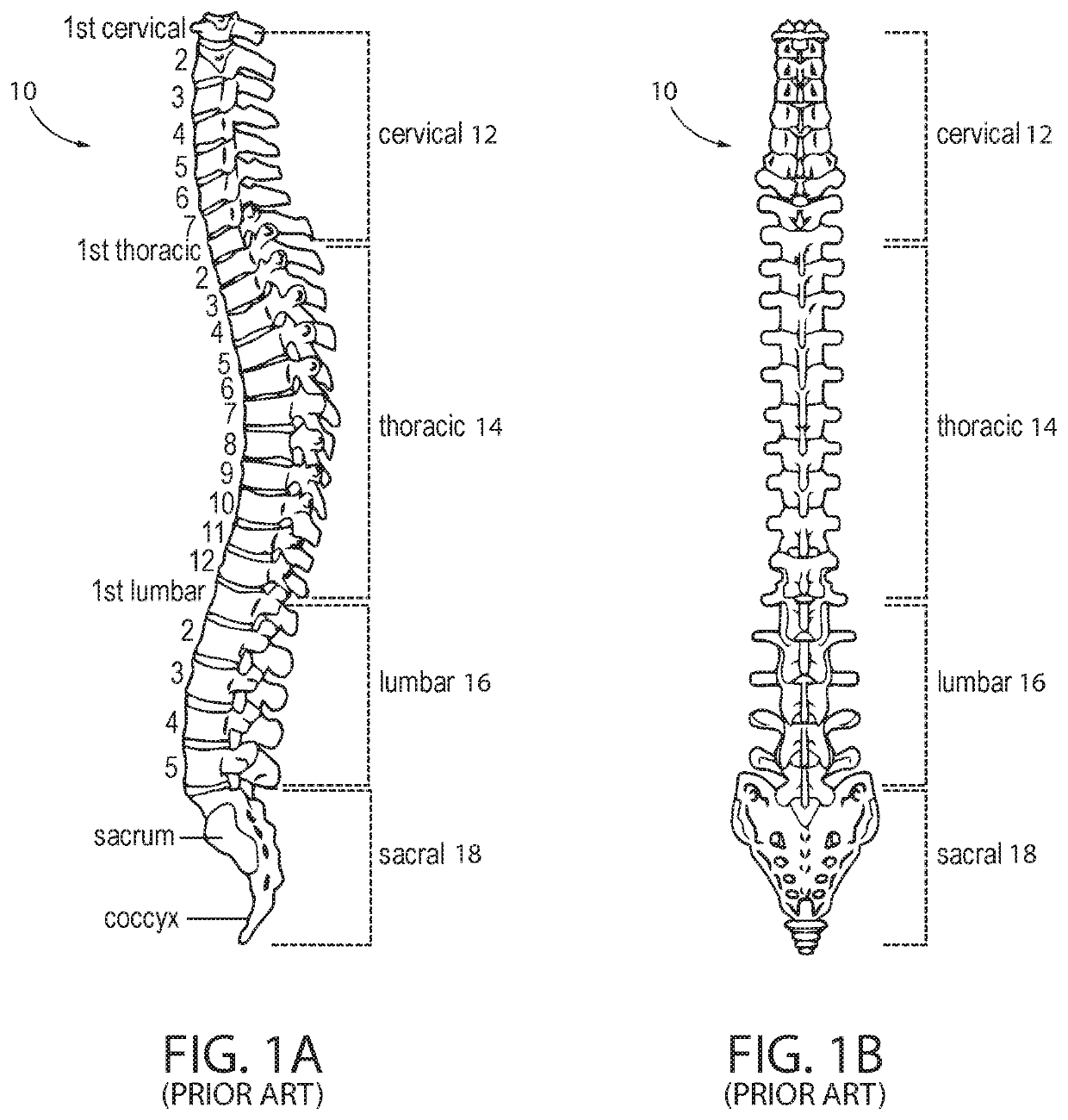 Pedicle screw placement system and method for spinal surgery