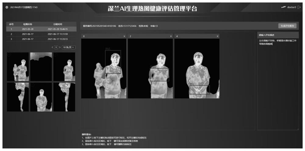 Physiological thermogram analysis device, electronic equipment and computer readable storage medium