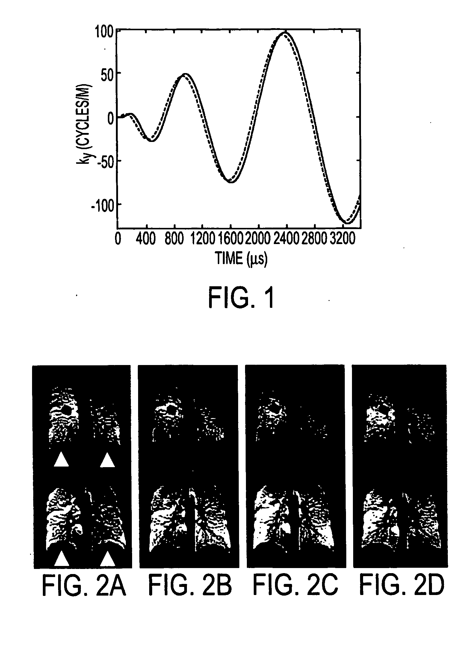 Optimized high-speed magnetic resonance imaging method and system using hyperpolarized noble gases