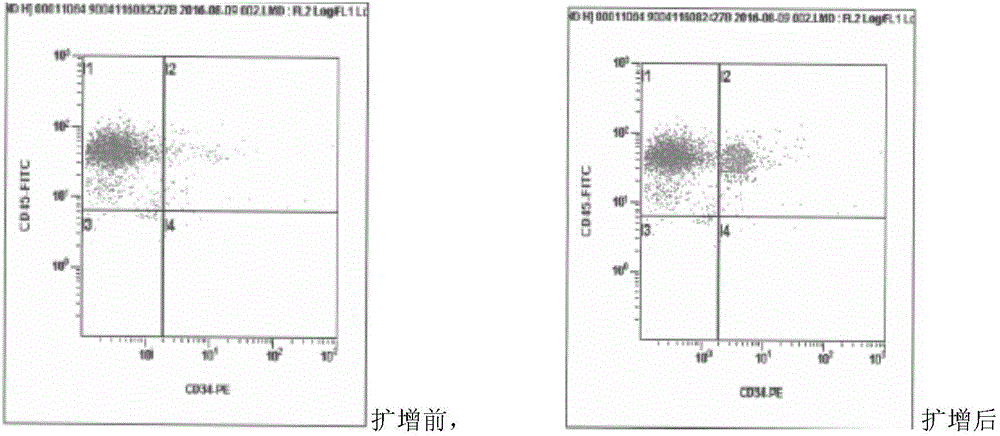 Method for separating hematopoietic stem cells from umbilical cord blood and amplifying CD34 positive cells