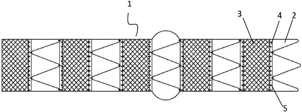 Non-covered vascular scaffold and method of releasing same