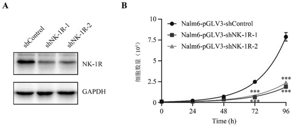 Application of combination of aprepitant and chemotherapeutic drugs to preparation of drugs for treating acute lymphoblastic leukemia