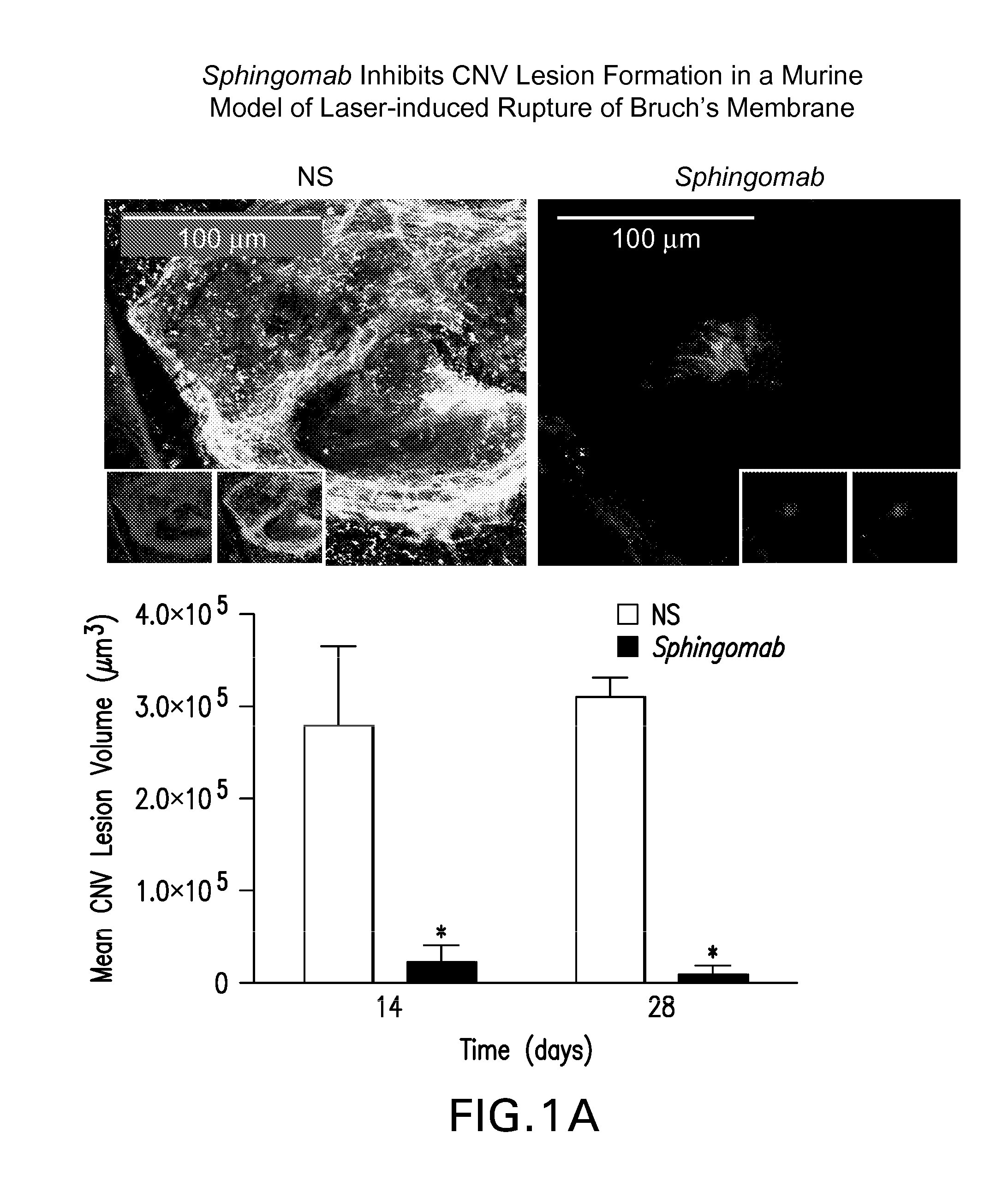 Compositions and methods for the treatment and prevention of fibrotic, inflammatory, and neovascularization conditions of the eye