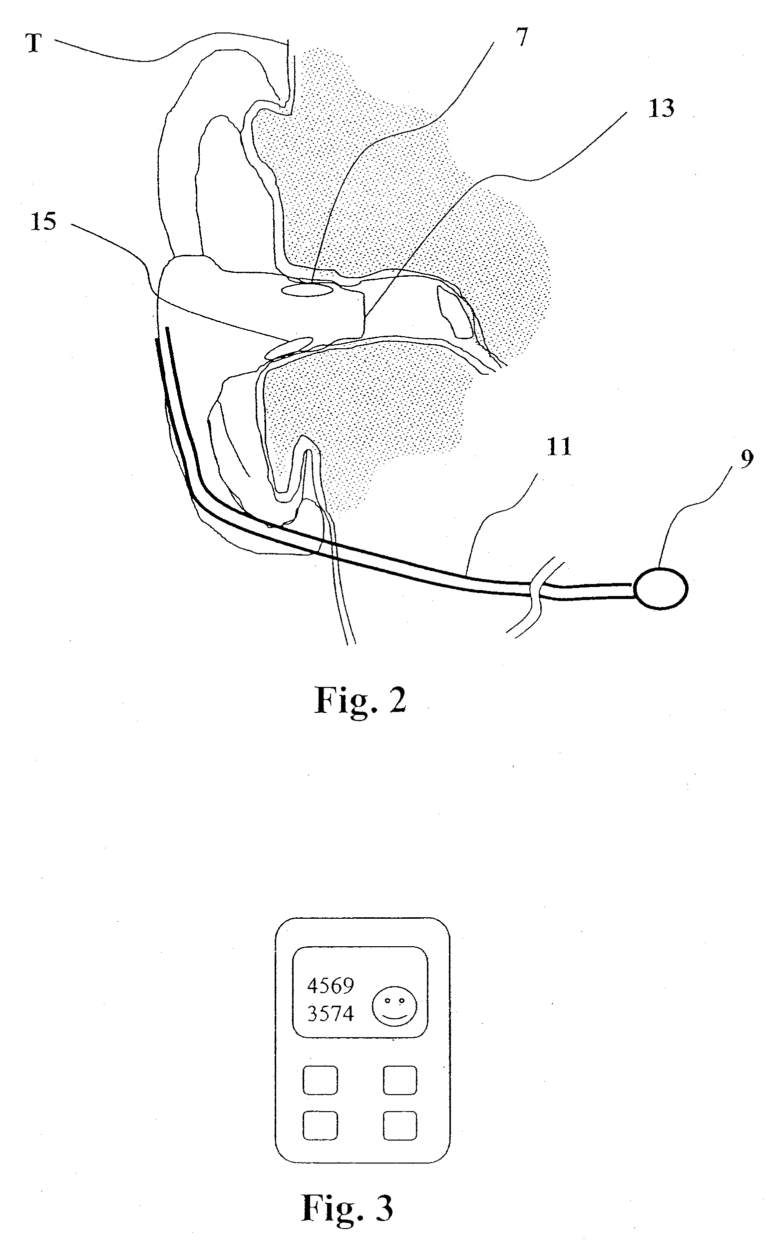 Device and method for determining a respiration rate