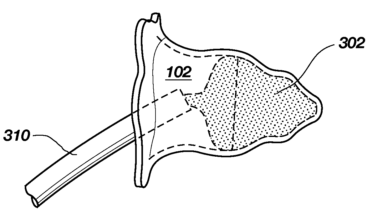 Medical device for modification of left atrial appendage and related systems and methods