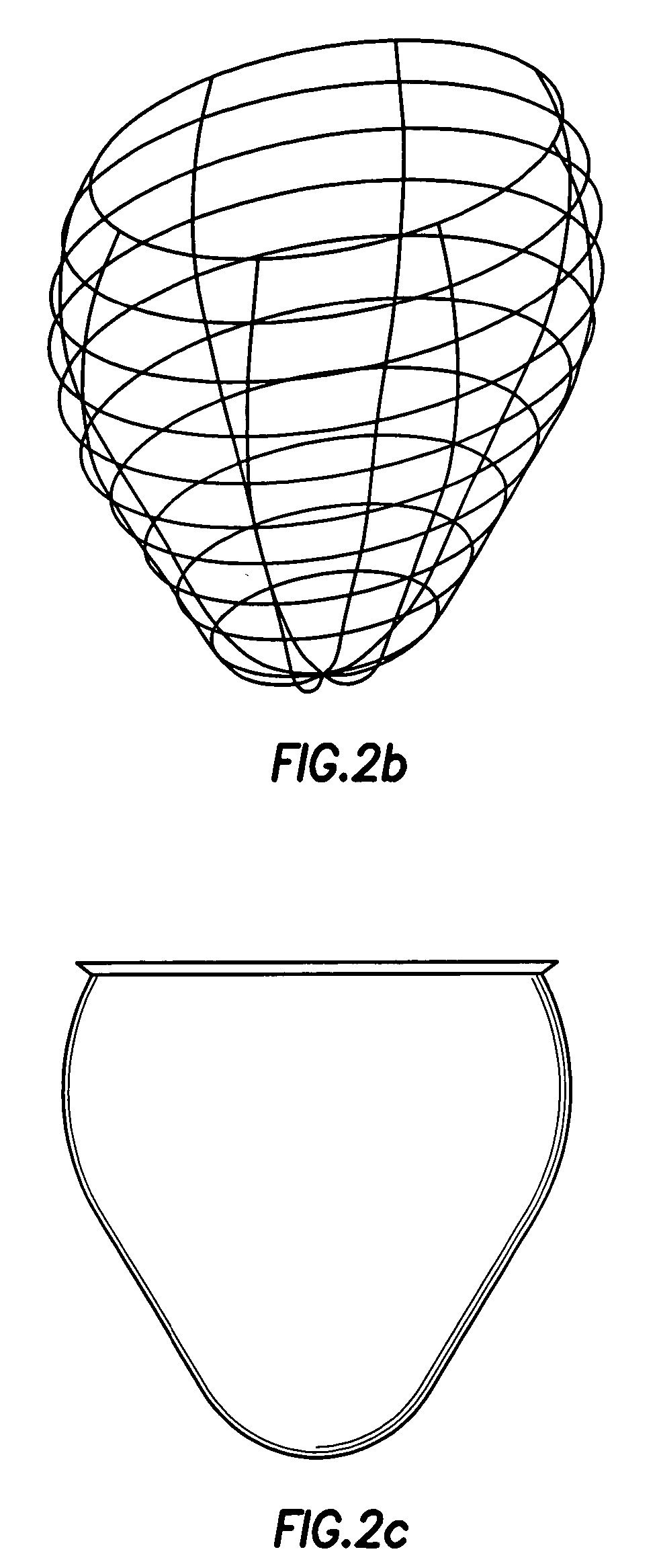 Device for proactive modulation of cardiac strain patterns