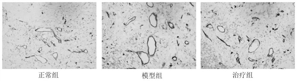 A traditional Chinese medicine composition for treating stable chronic obstructive pulmonary disease and its preparation method