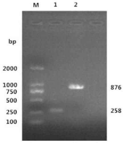 Method for building disease model for mice infected with bacterial sepsis and judging disease situations