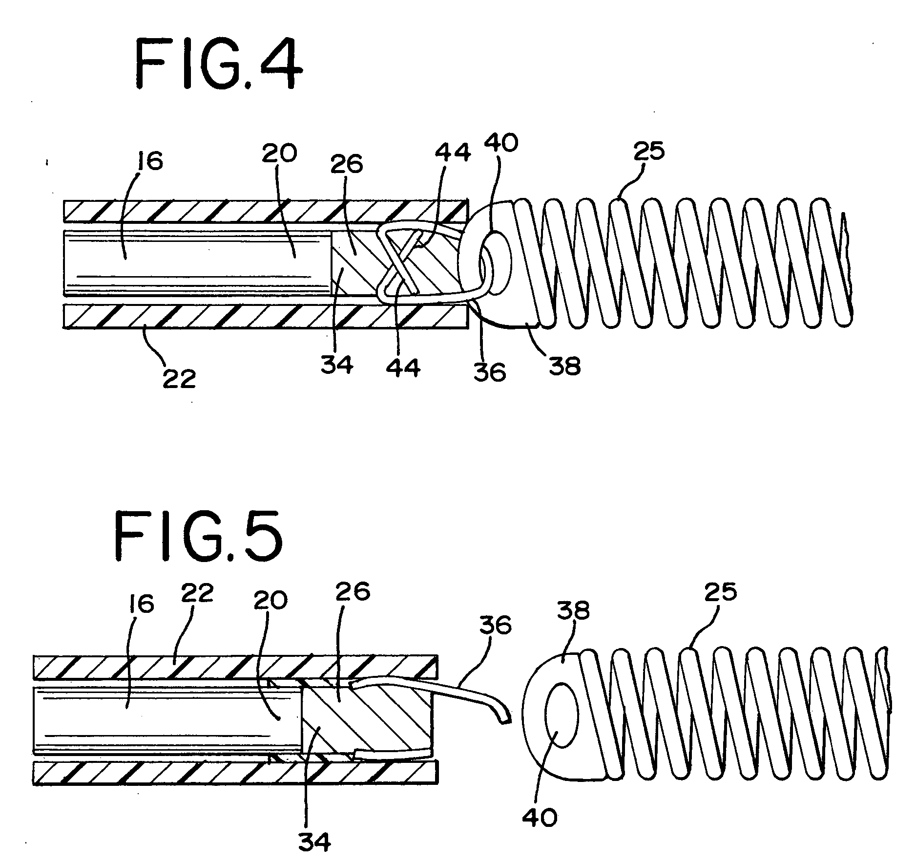 Laser-based vascular occlusion device detachment system