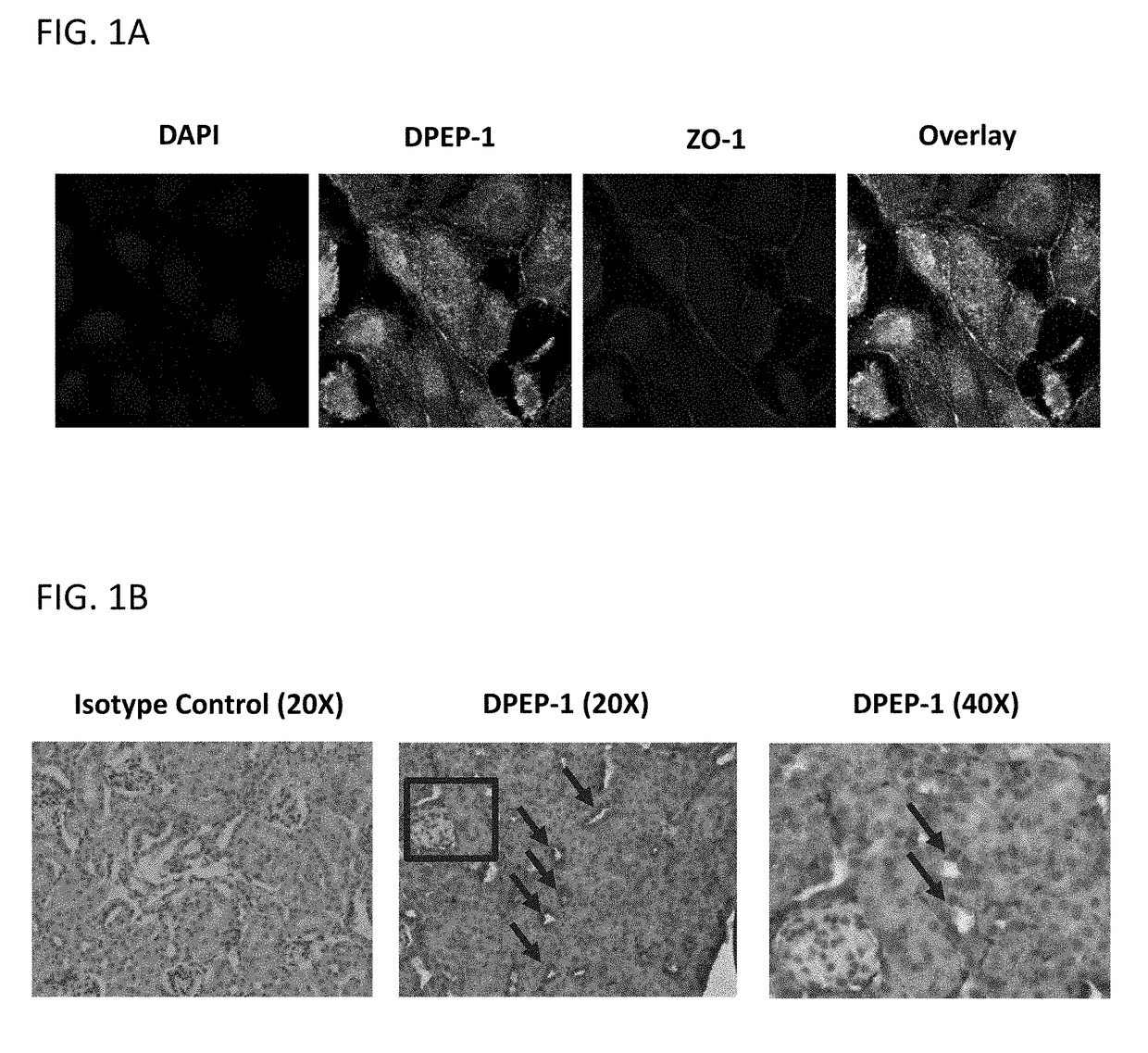 Dpep-1 binding compositions and methods of use