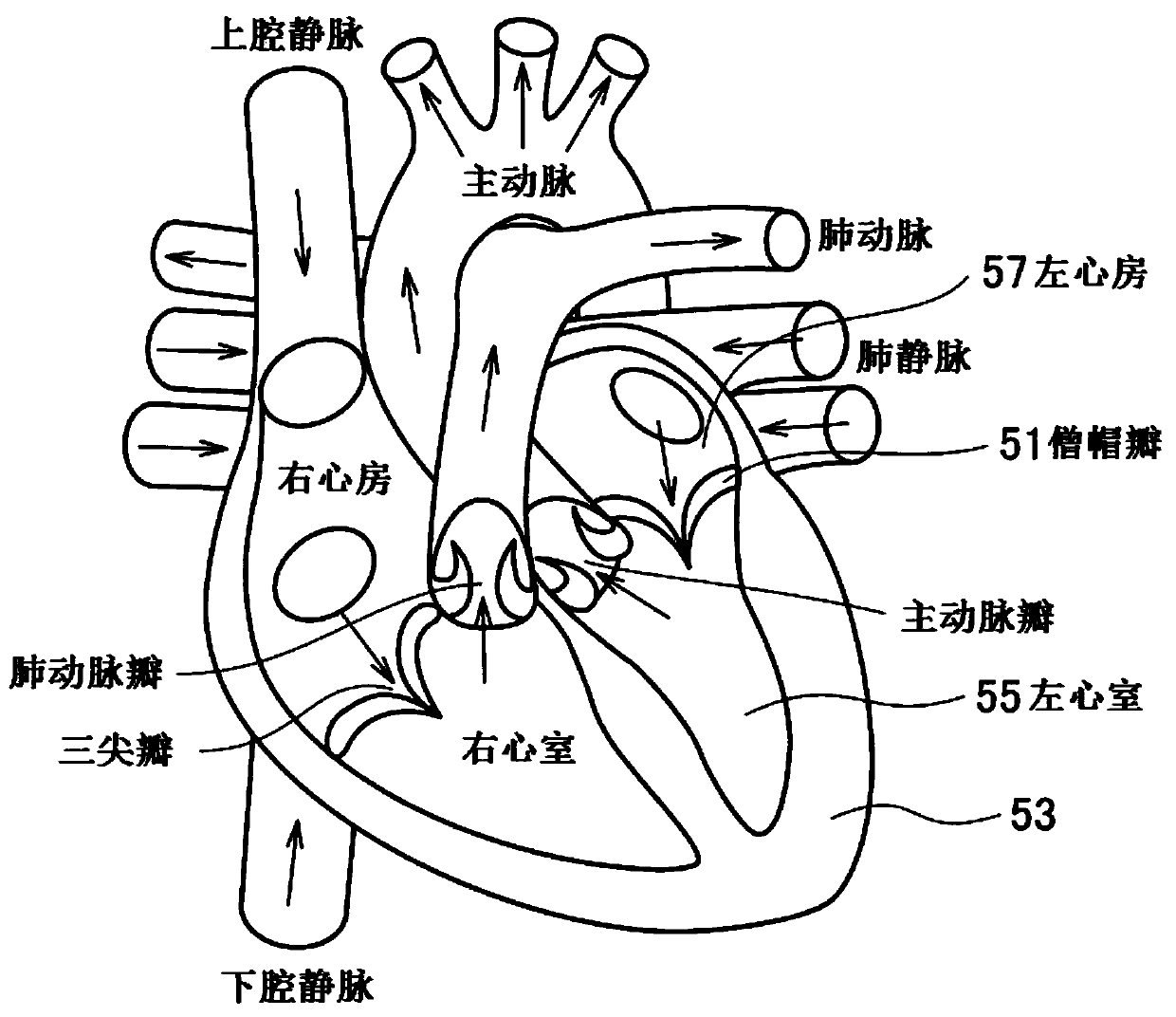 Artificial heart valve