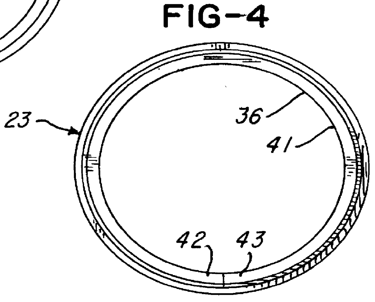 Suture ring for heart valve prosthesis