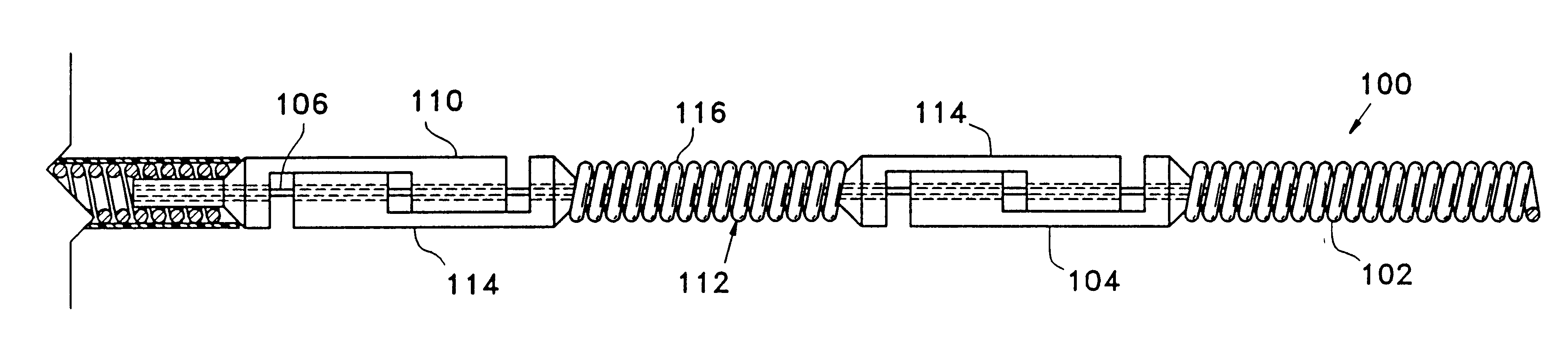 Detachable embolic coil assembly using interlocking clasps and method of use