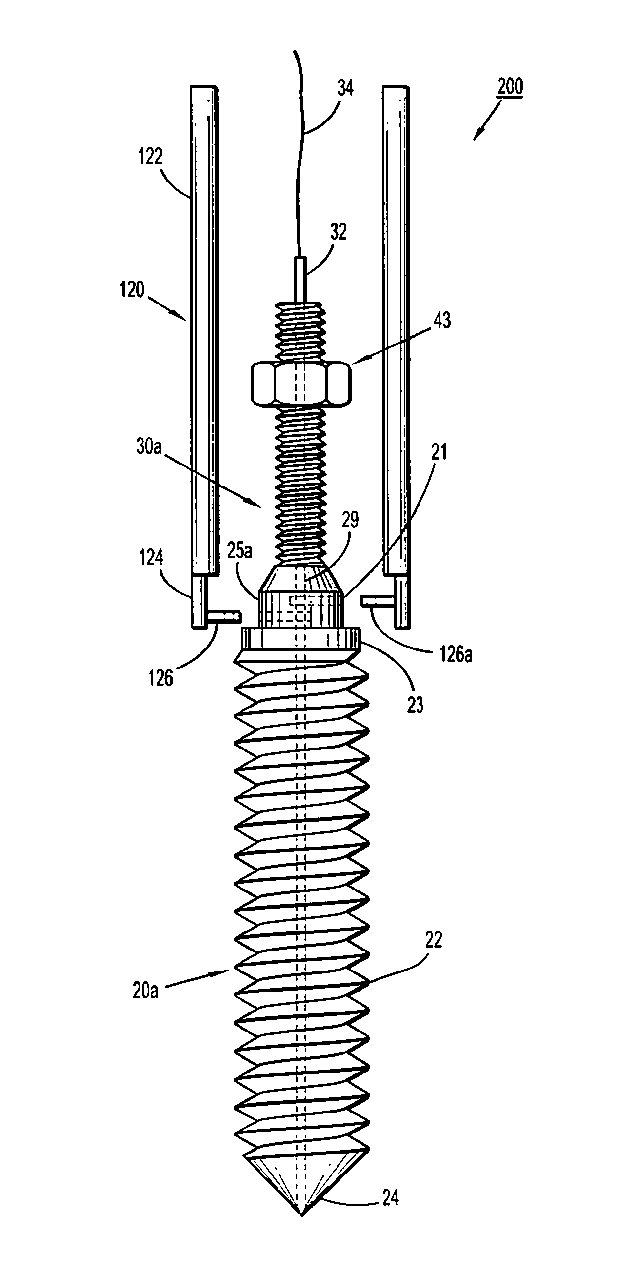 Minimally invasive retractor and posted screw