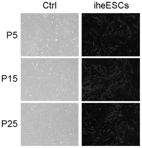 Construction and identification of immortalized human endometriosis eutopic stromal cells