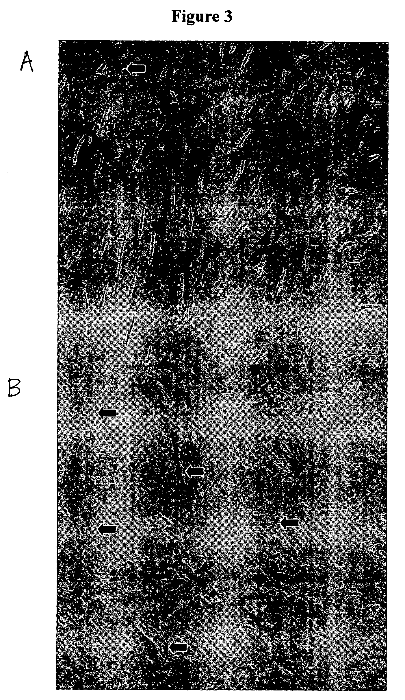 Methods and compositions for preventing vasospasm