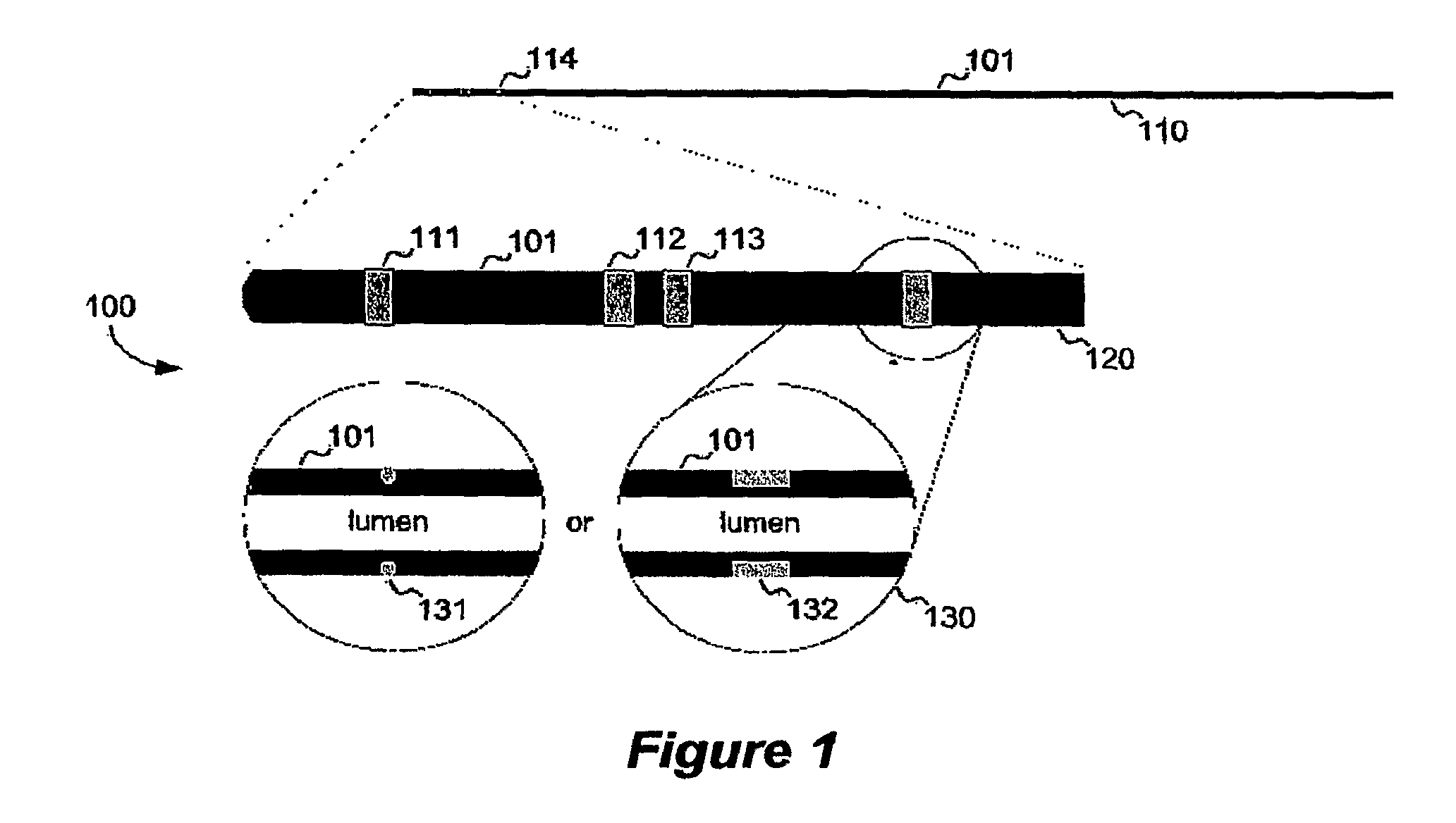 Devices, Systems and Methods for Determining Sizes of Vessels