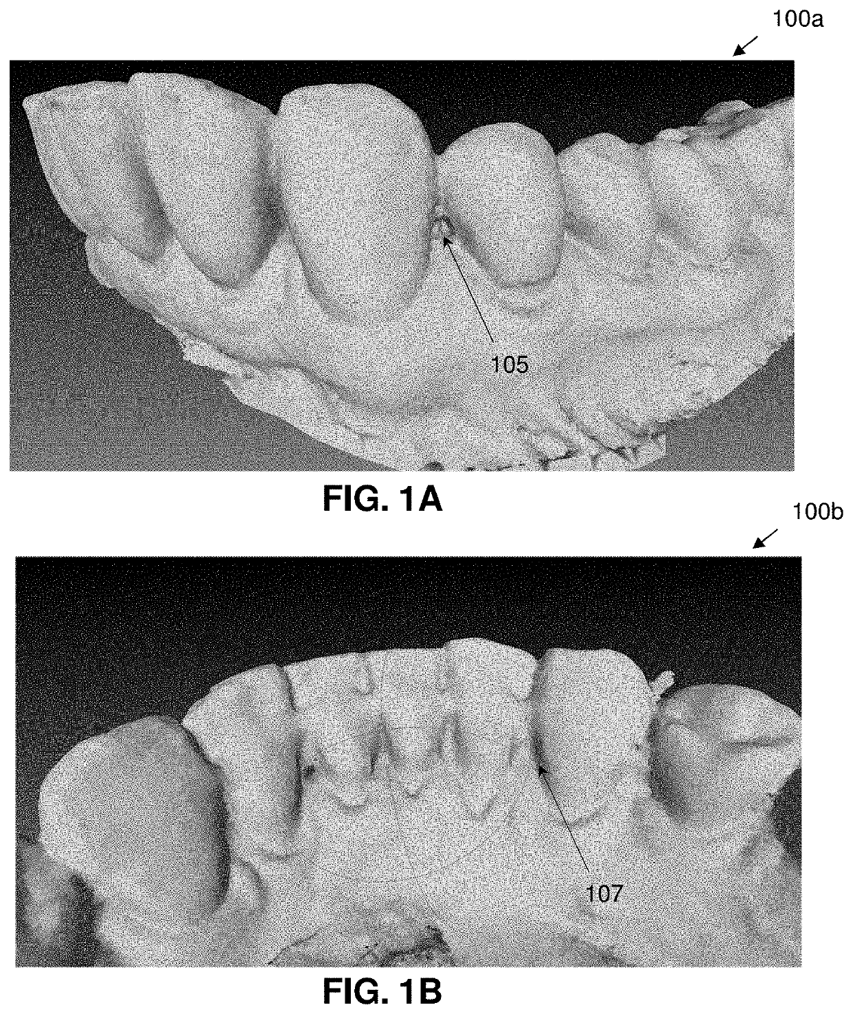 Artificially intelligent systems to manage virtual dental models using dental images