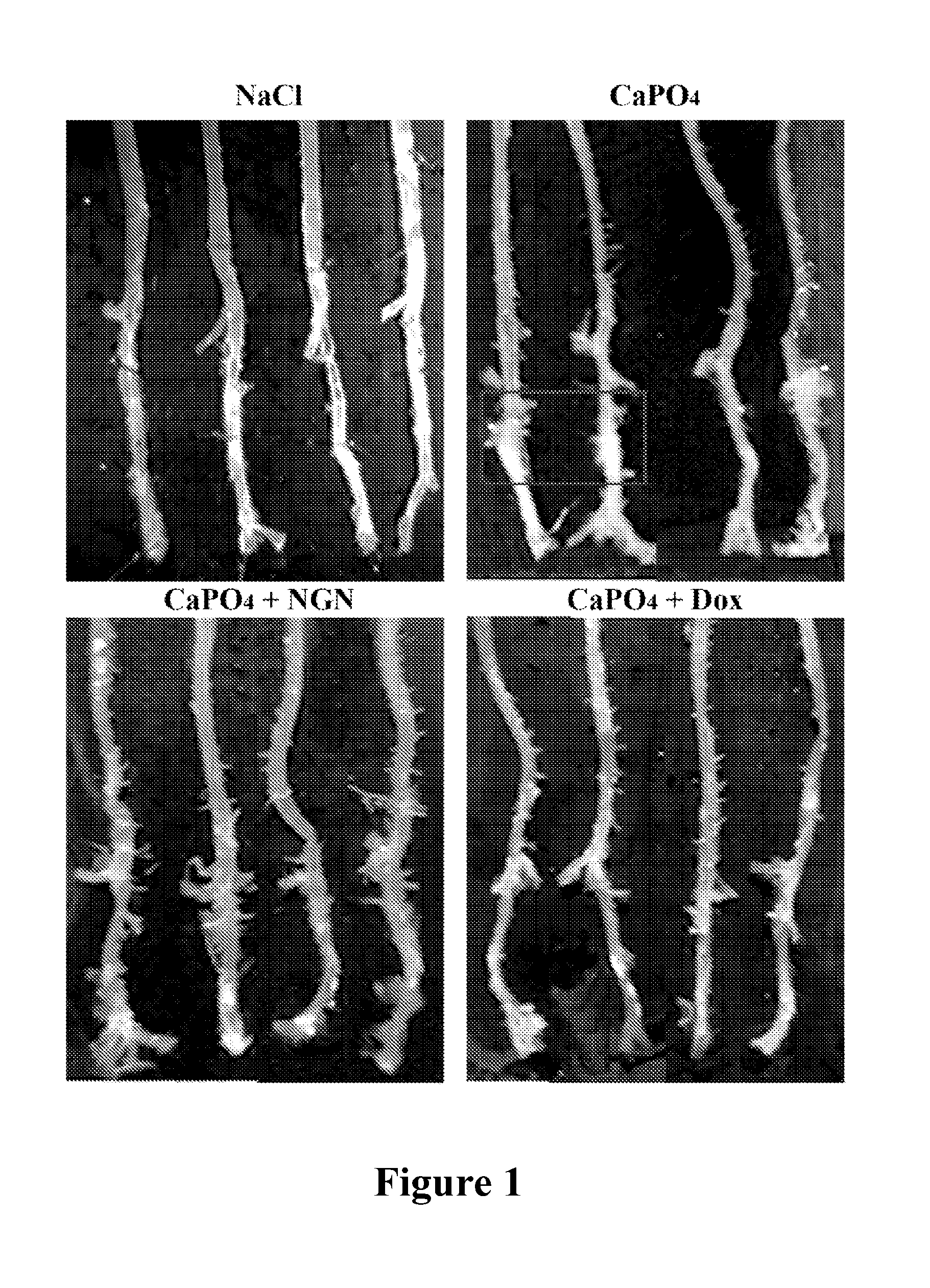 Use of naringenin in preparing drugs for preventing and/or treatment abdominal aortic aneurysm