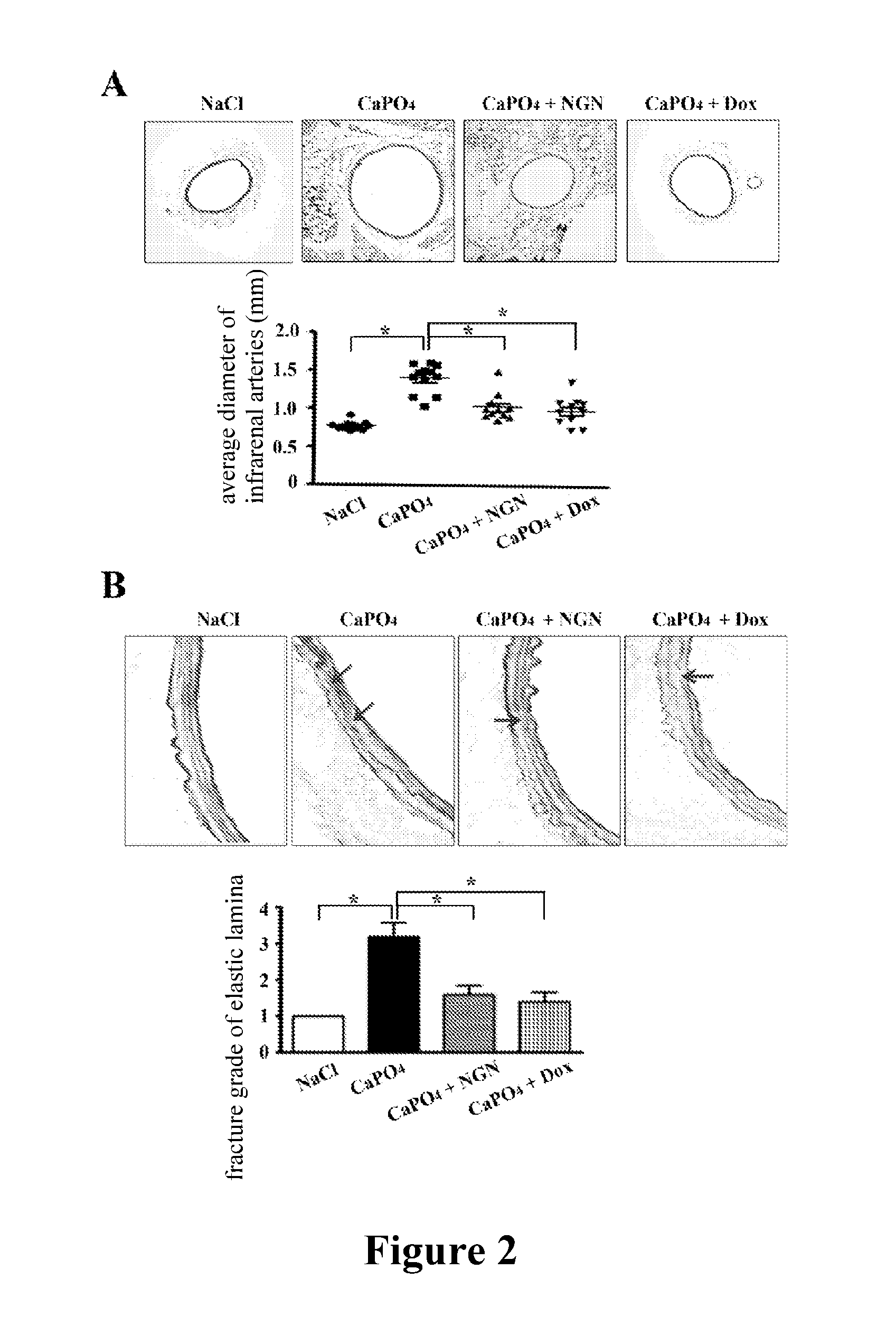 Use of naringenin in preparing drugs for preventing and/or treatment abdominal aortic aneurysm