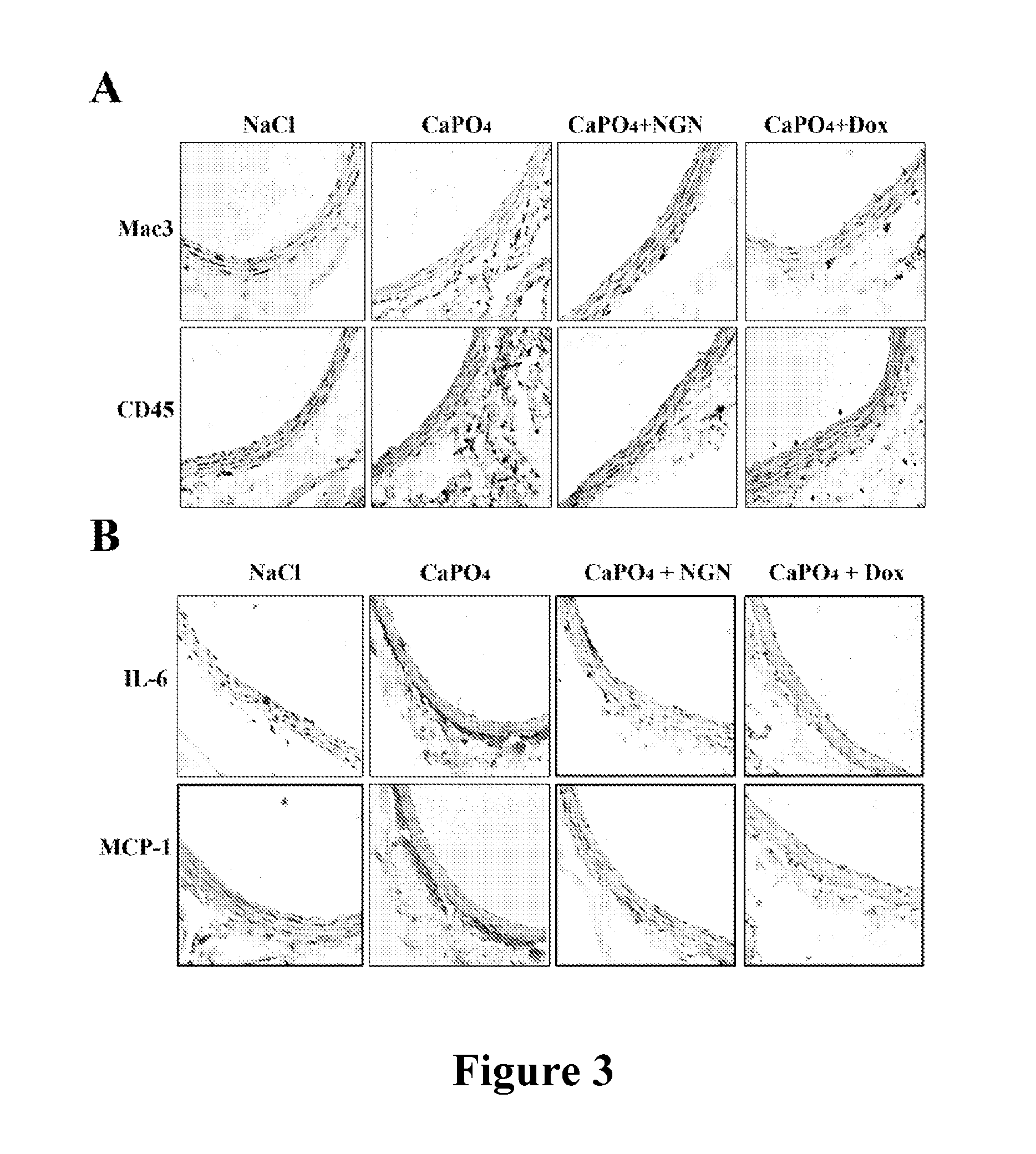 Use of naringenin in preparing drugs for preventing and/or treatment abdominal aortic aneurysm