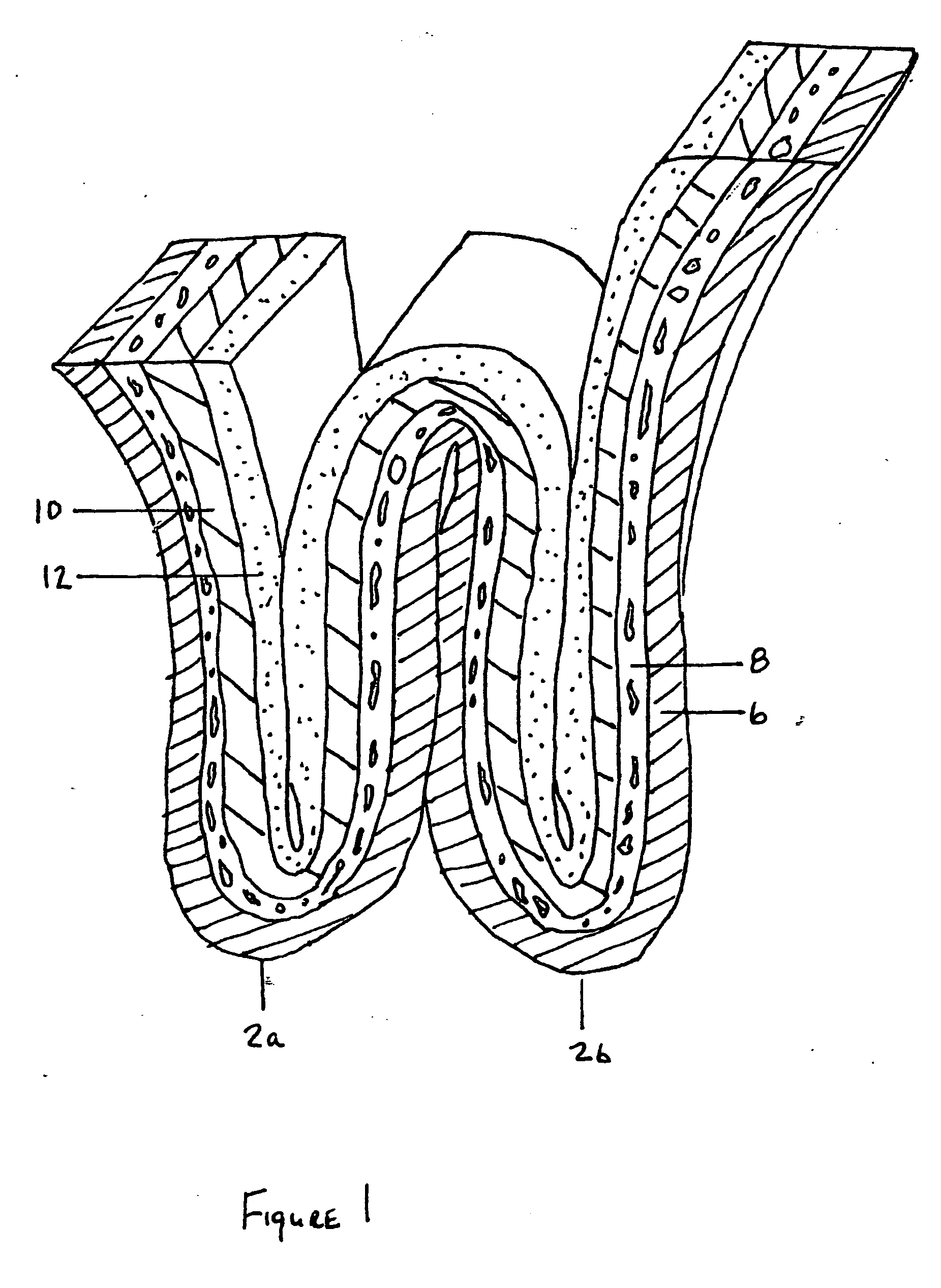 Methods and apparatus for excising tissue and creating wall-to-wall adhesions from within an organ