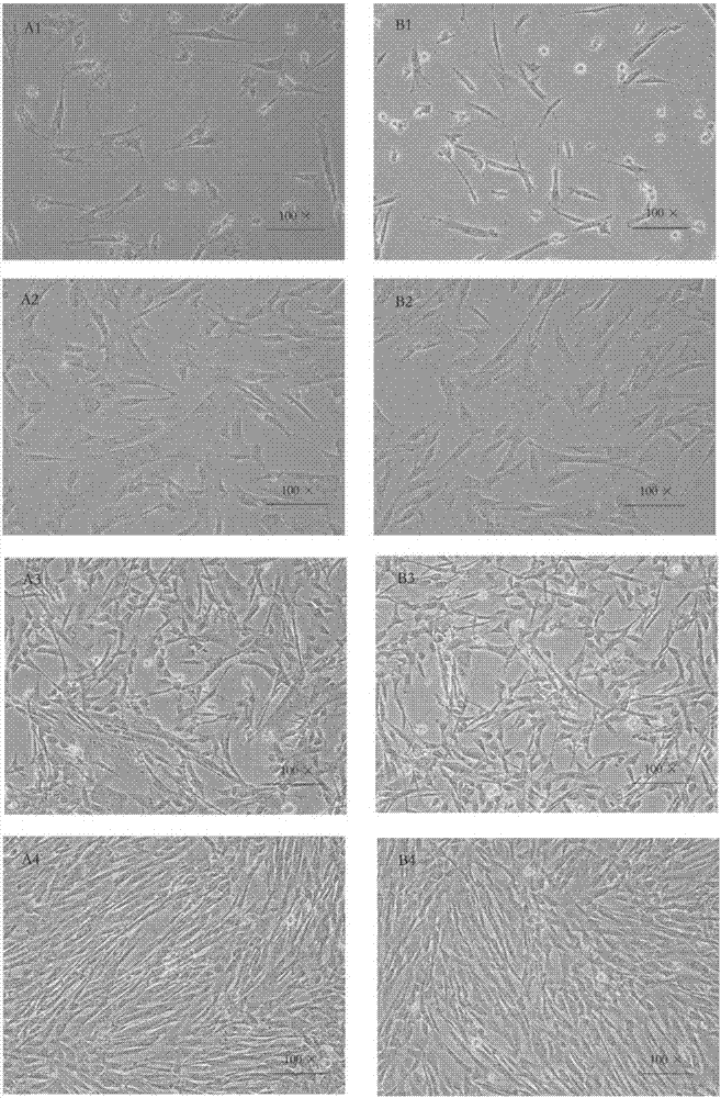 Serum-free cryoprotectant, and application thereof in cryopreservation of mesenchymal stem cells