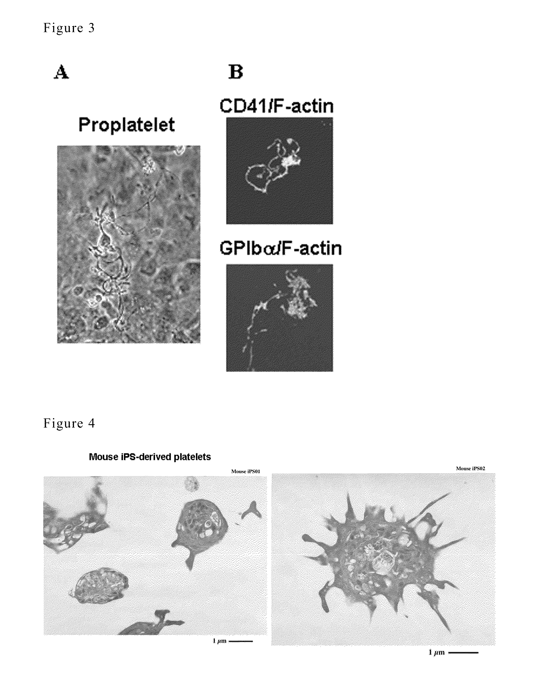 METHOD FOR PREPARATION OF PLATELET FROM iPS CELL