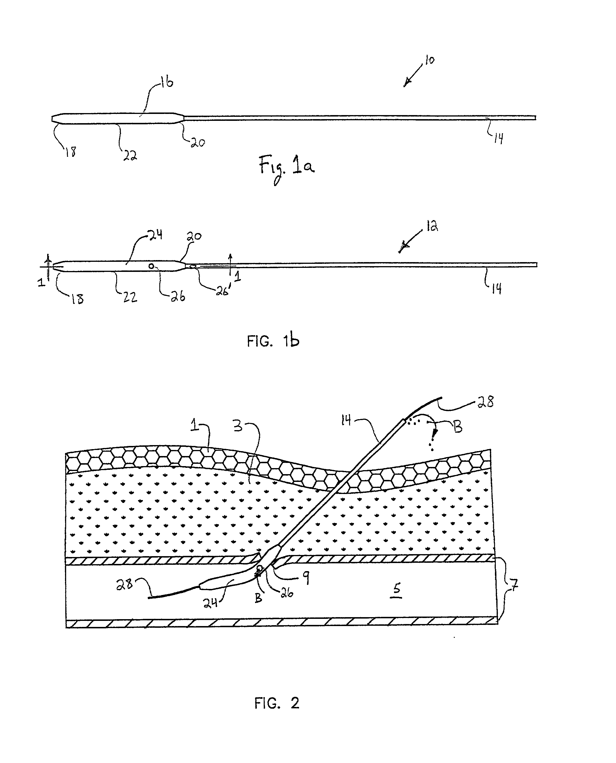 Depth and puncture control for blood vessel hemostasis system