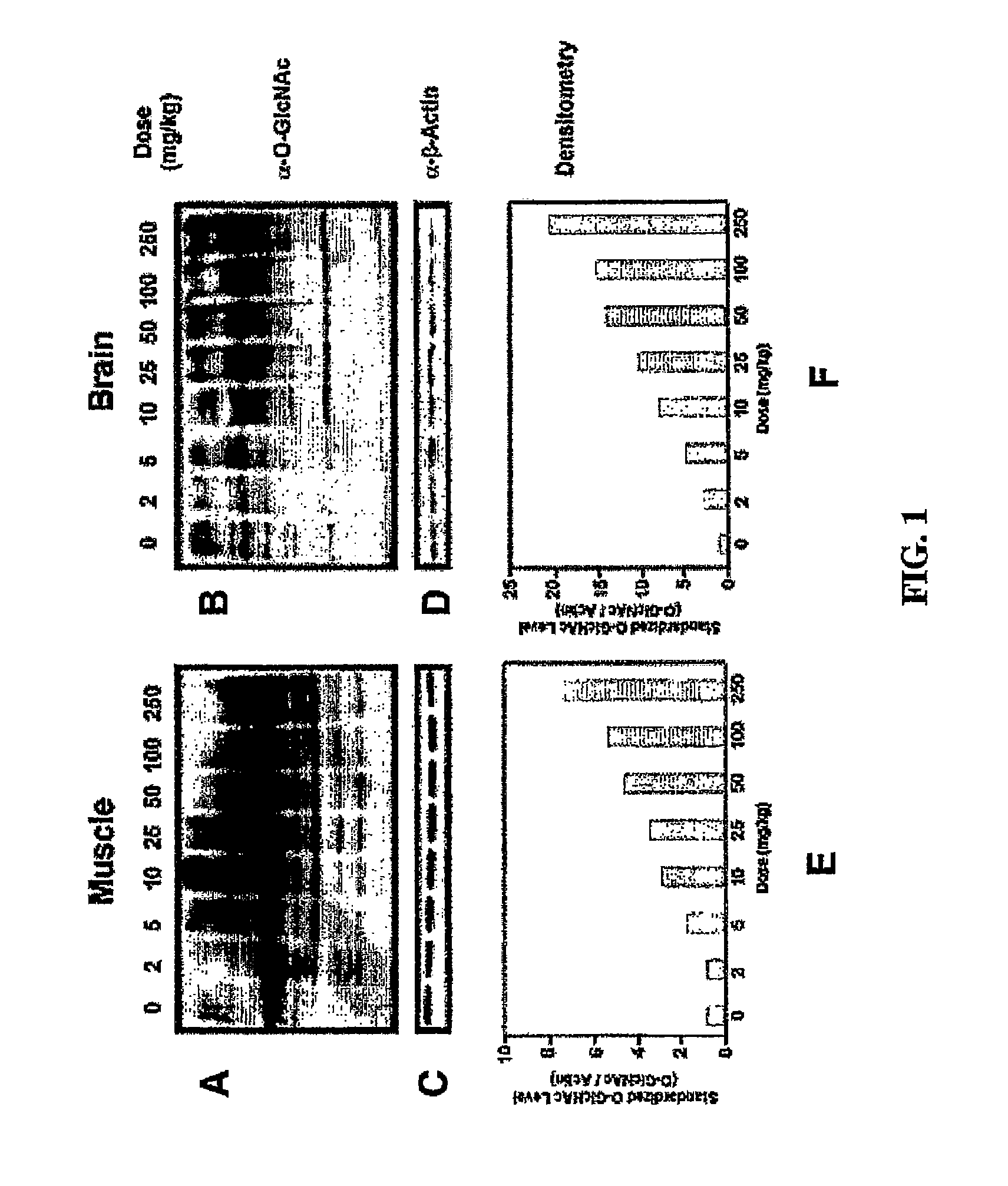 Selective glycosidase inhibitors and uses thereof