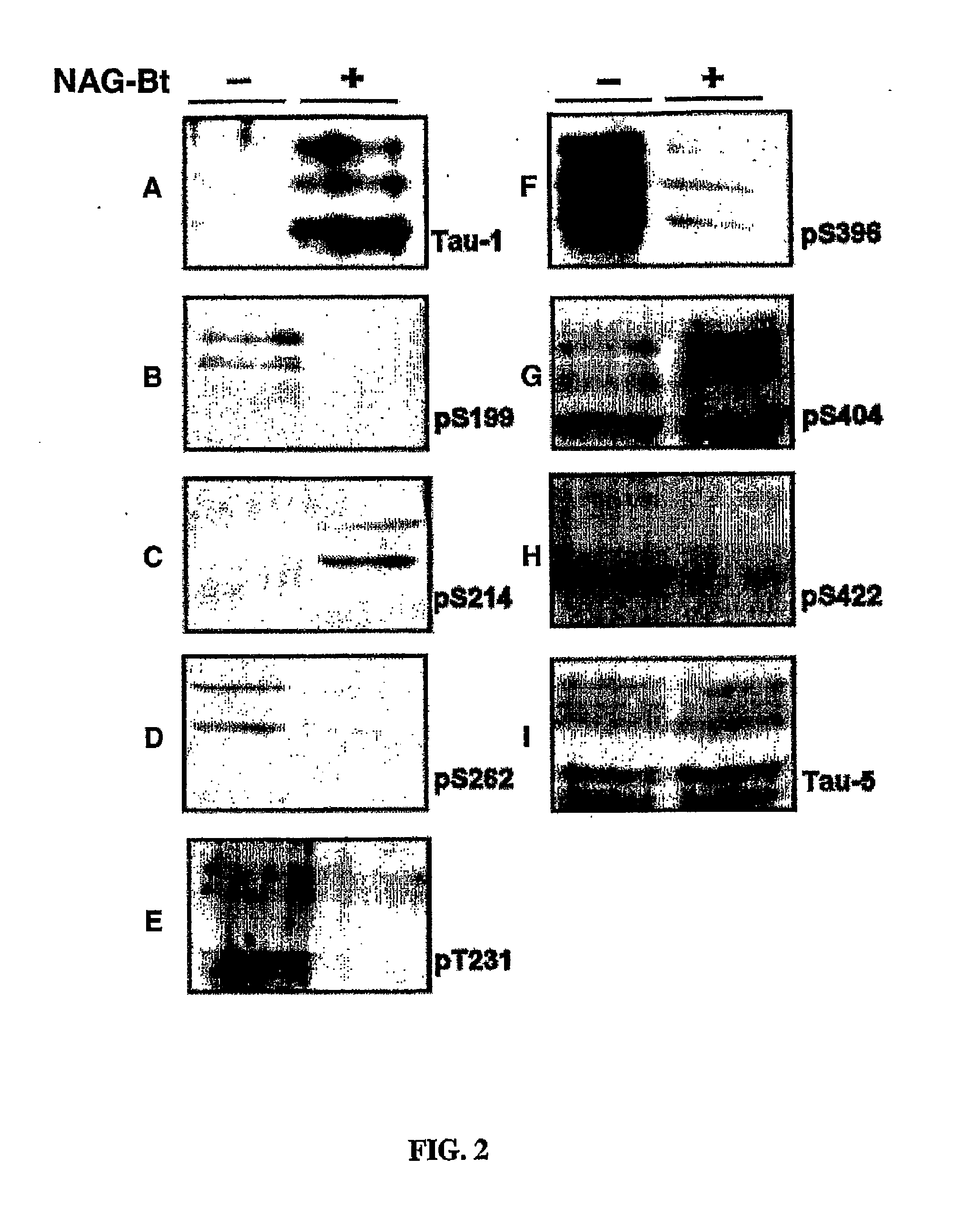 Selective glycosidase inhibitors and uses thereof