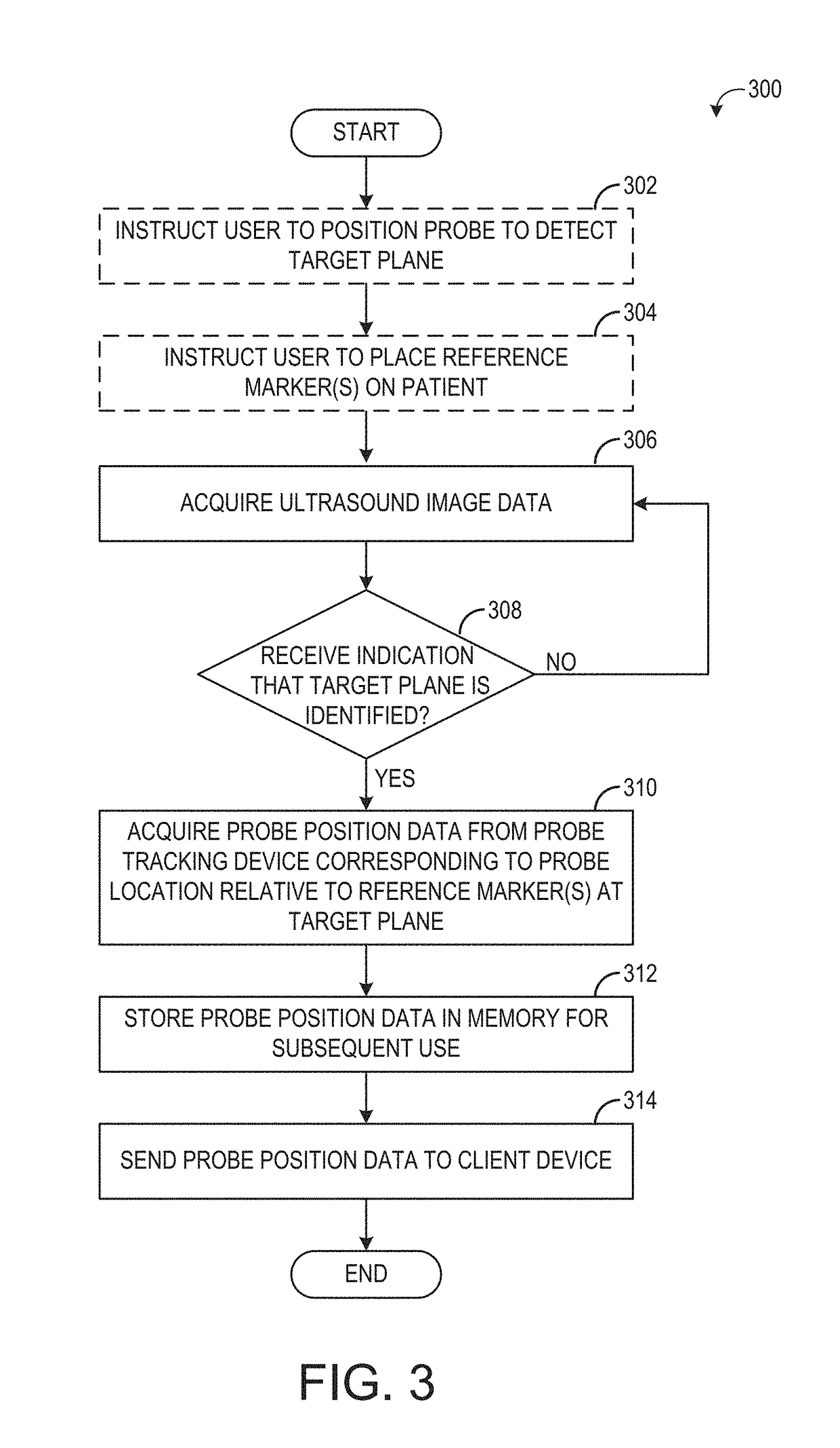 System and methods for at-home ultrasound imaging
