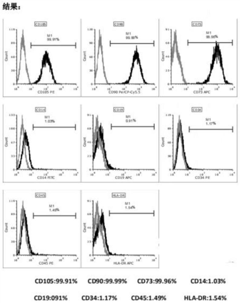 Exosome preparation deriving from human umbilical cord mesenchymal stem cells