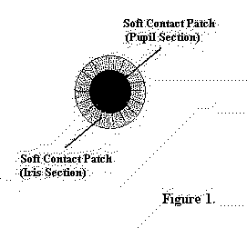 Soft Contact Patch for Treatment of Amblyopia