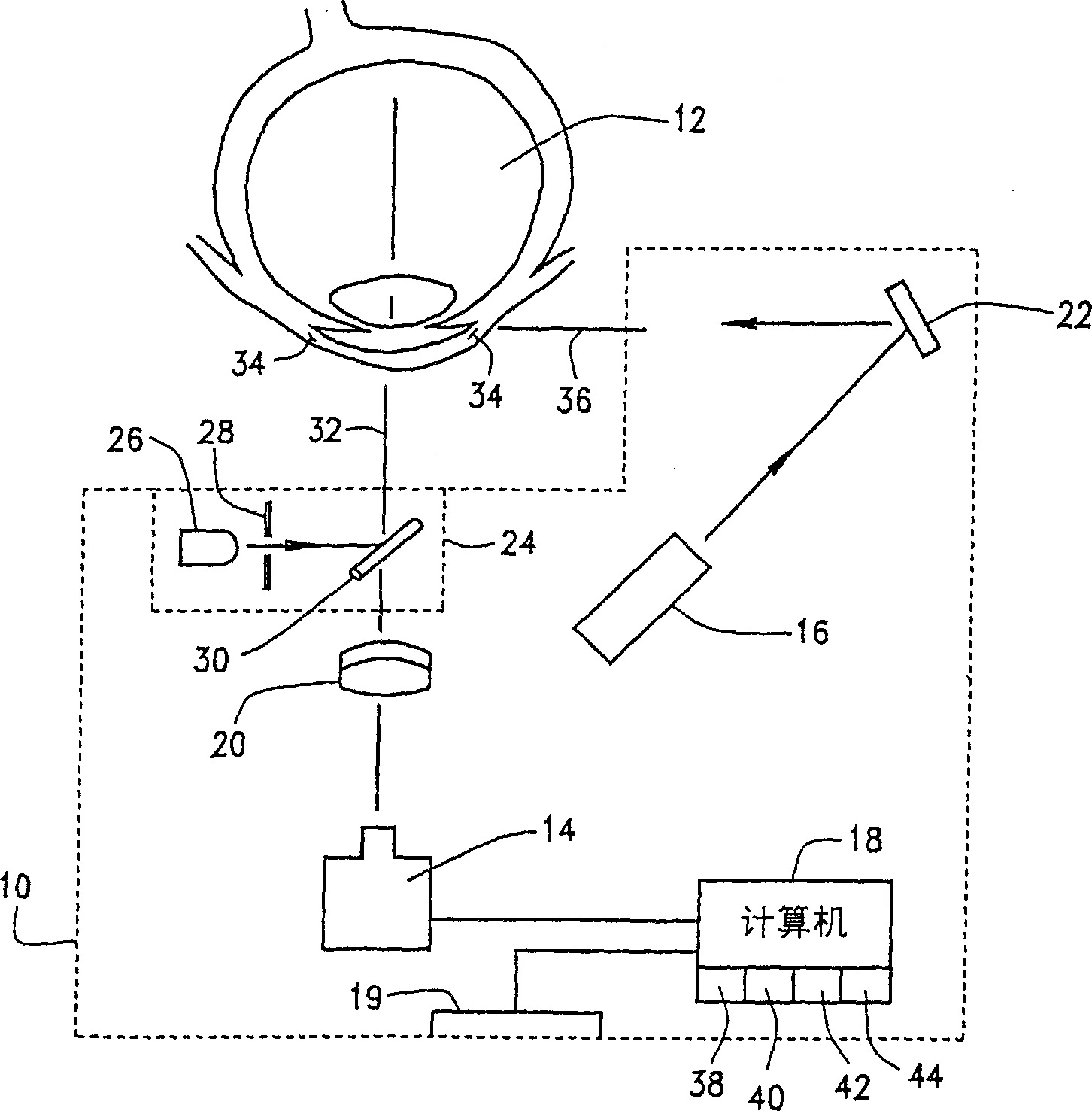 Anterior chamber diameter measurement system from limbal ring measurement