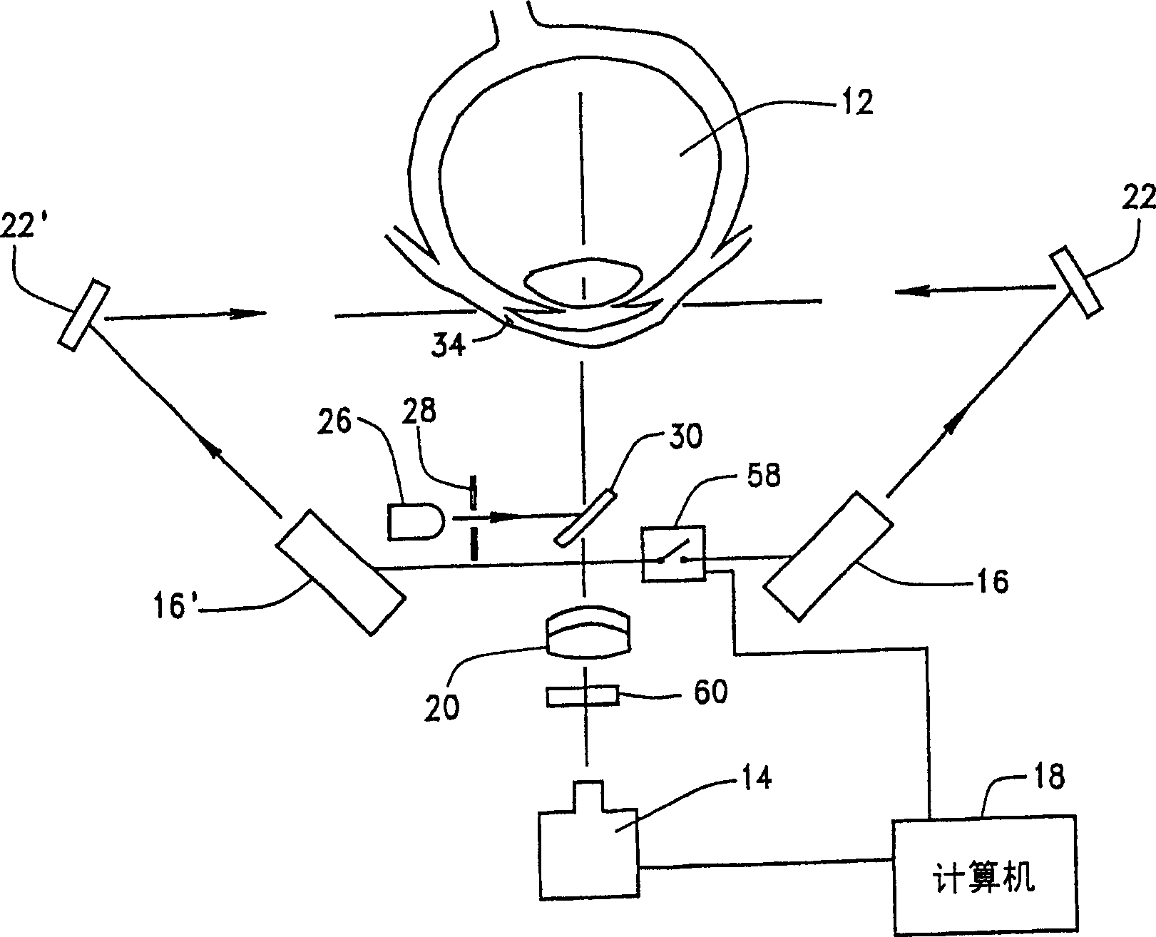 Anterior chamber diameter measurement system from limbal ring measurement