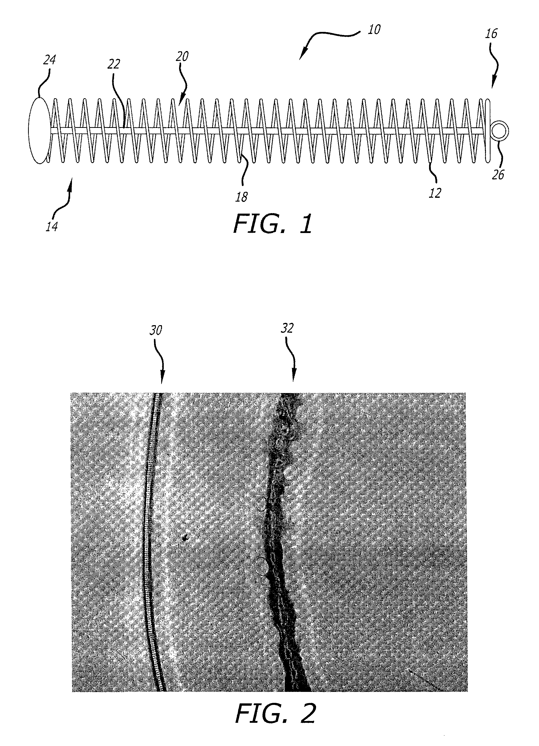 Multistrand coil for interventional therapy