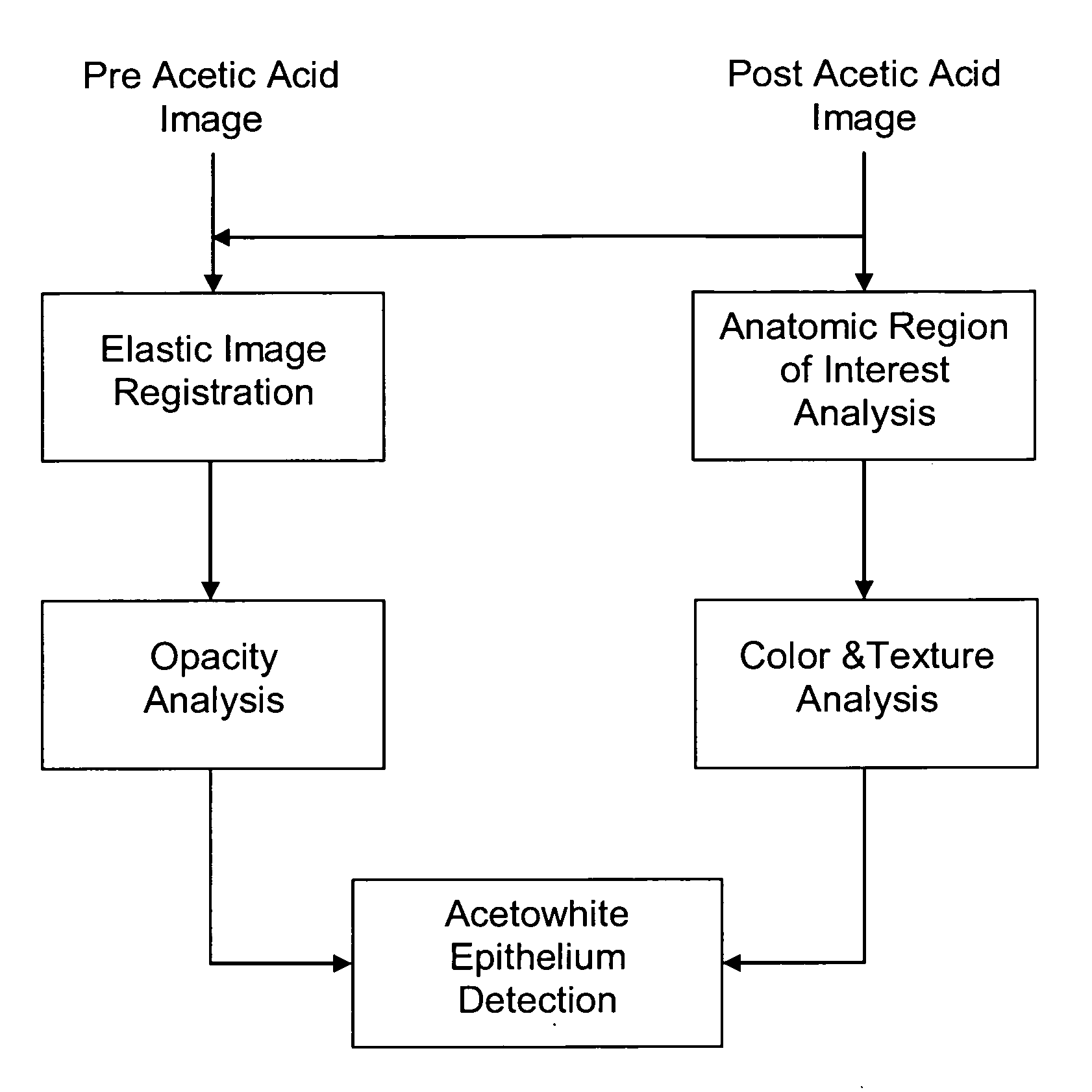 Computerized image analysis for acetic acid induced Cervical Intraepithelial Neoplasia