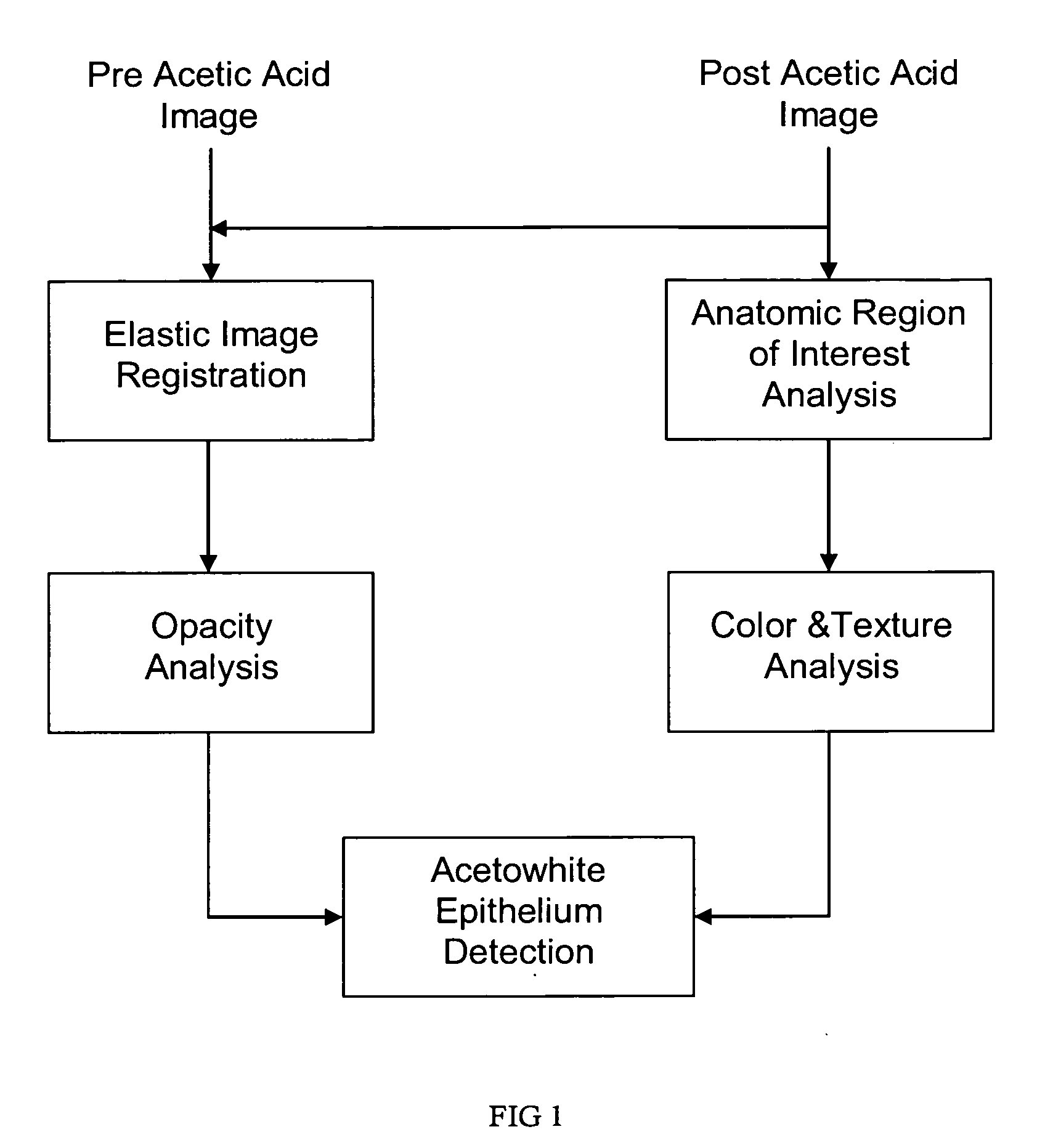 Computerized image analysis for acetic acid induced Cervical Intraepithelial Neoplasia
