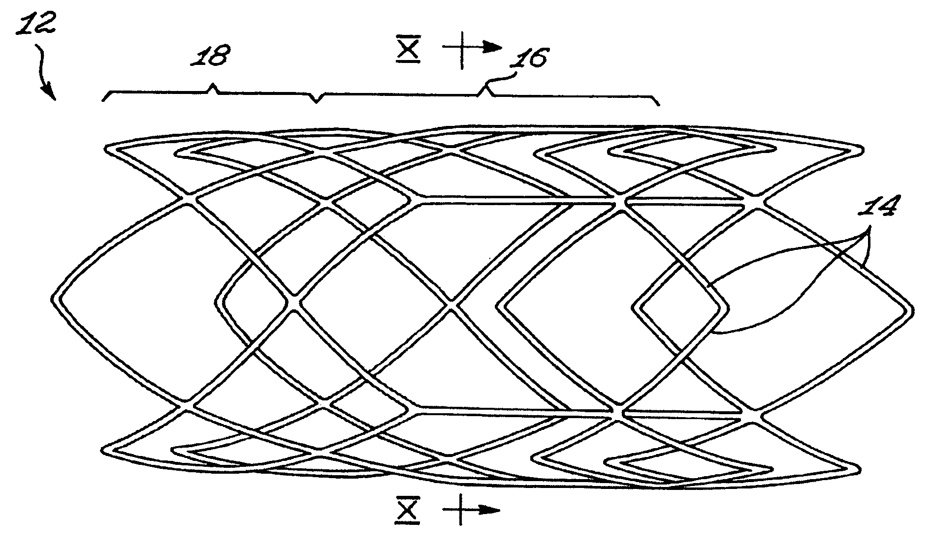 Stent and method of manufacturing same