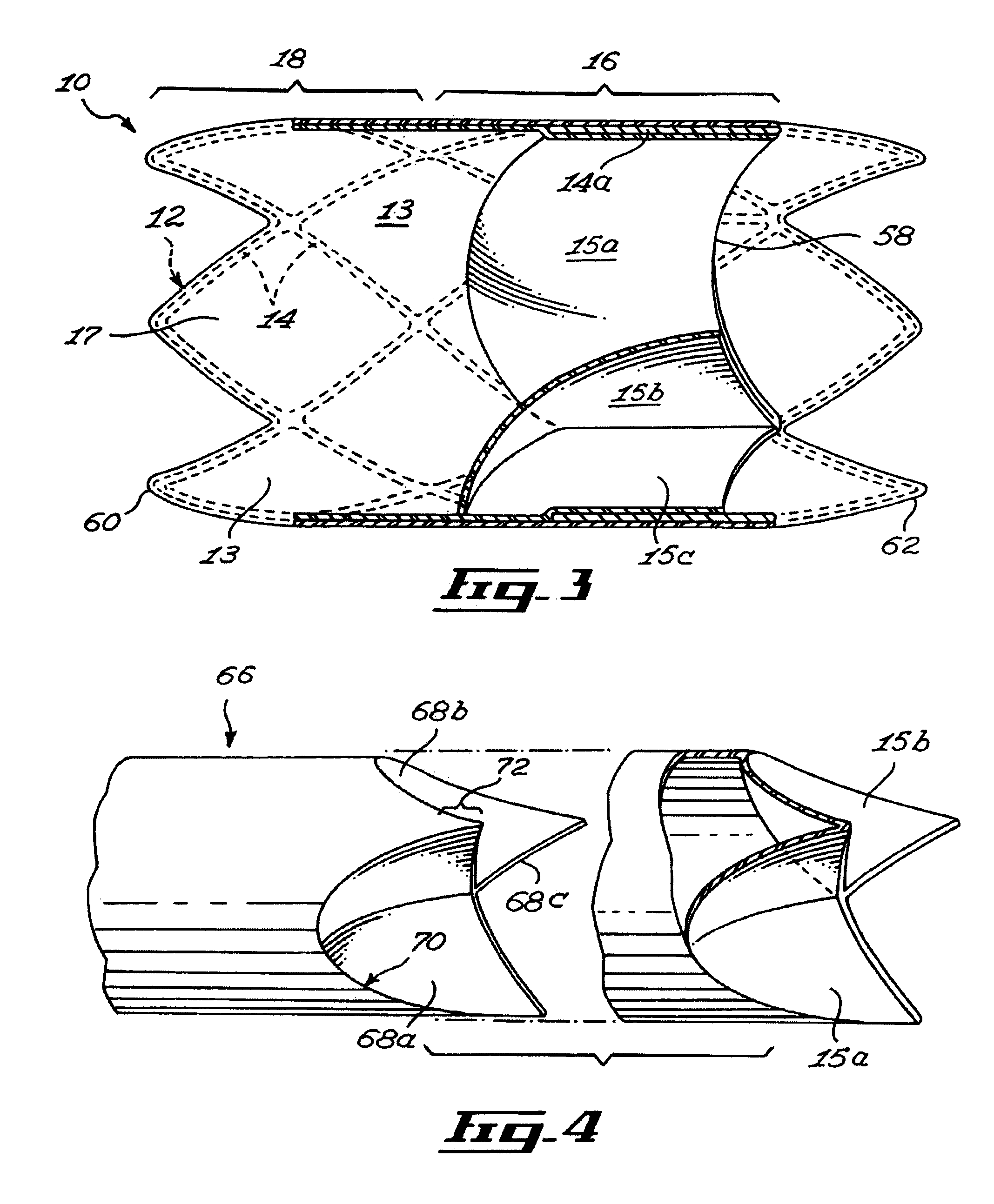 Stent and method of manufacturing same
