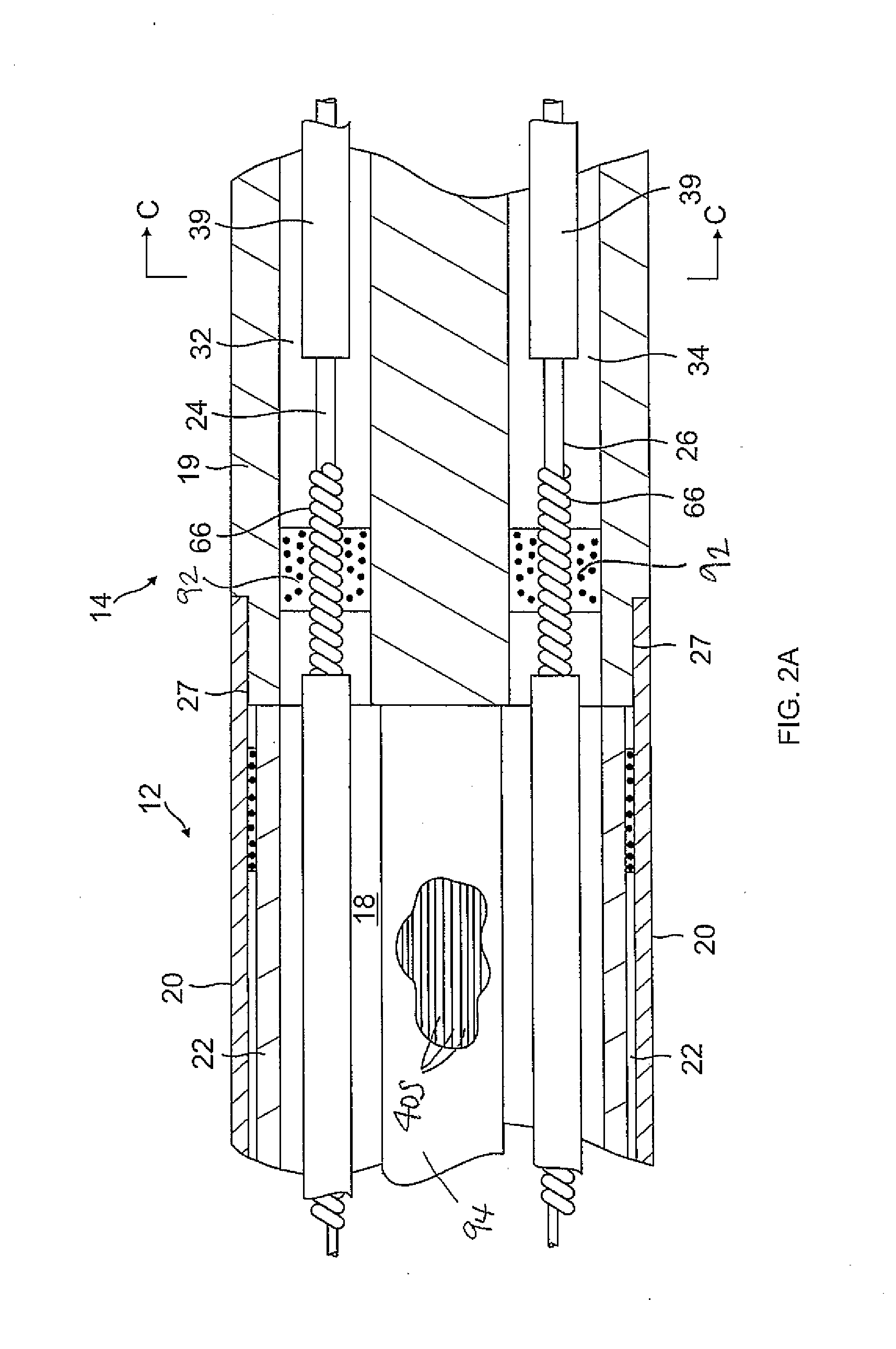 Catheter having closed loop array with in-plane linear electrode portion