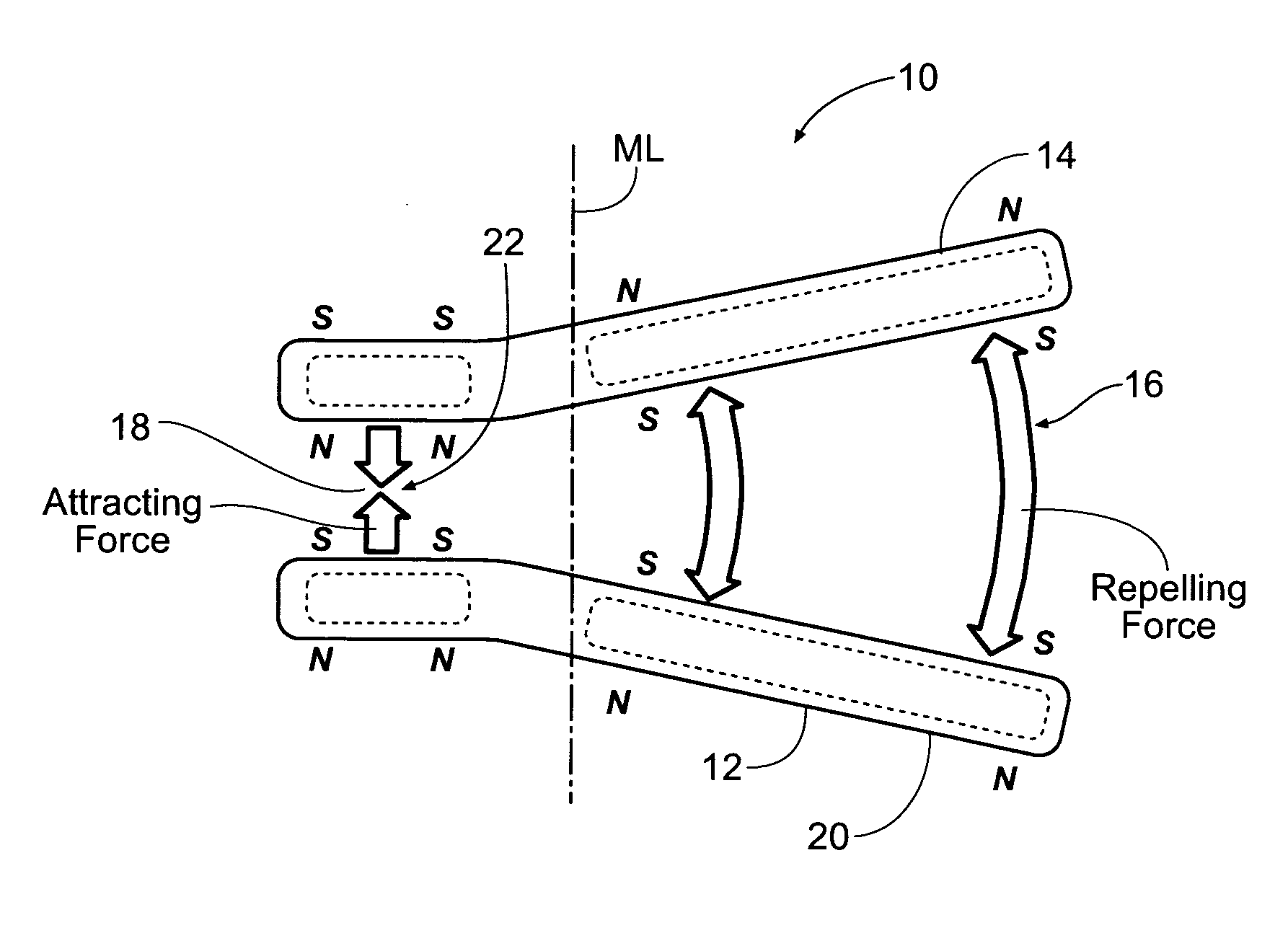 Self-anchoring magnetic force implant devices, systems, and methods
