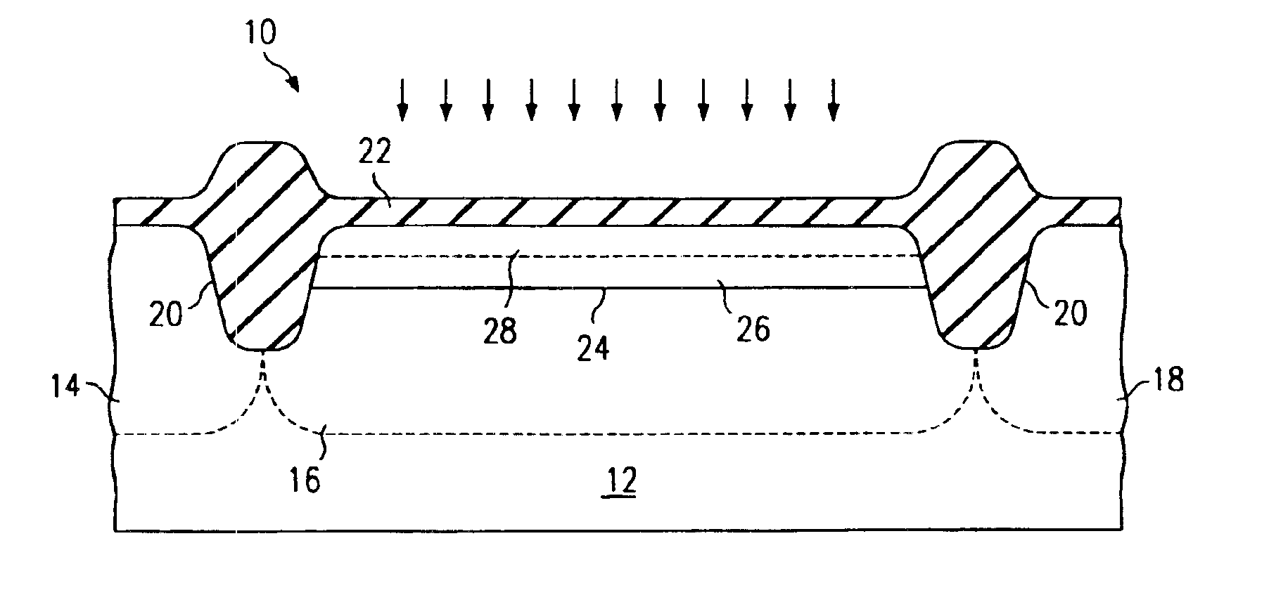 Dual-counterdoped channel field effect transistor and method