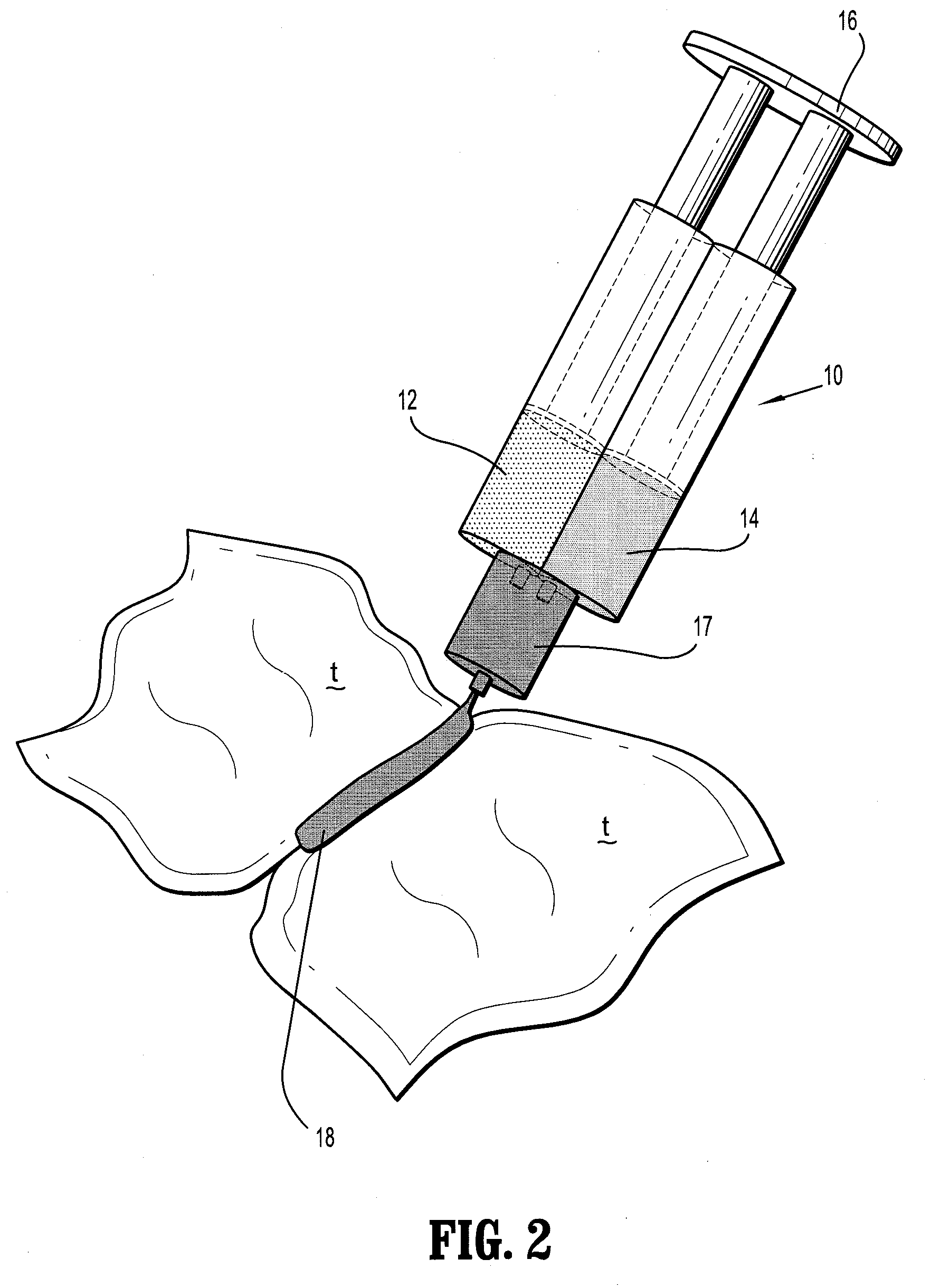 Bioabsorbable Surgical Compositions