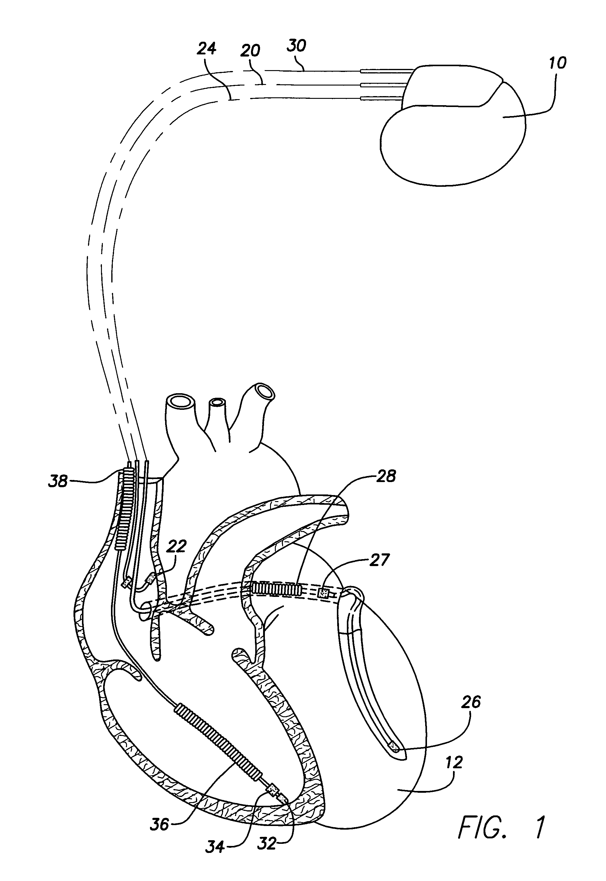 Method and apparatus to backup, update and share data among implantable cardiac stimulation device programmers