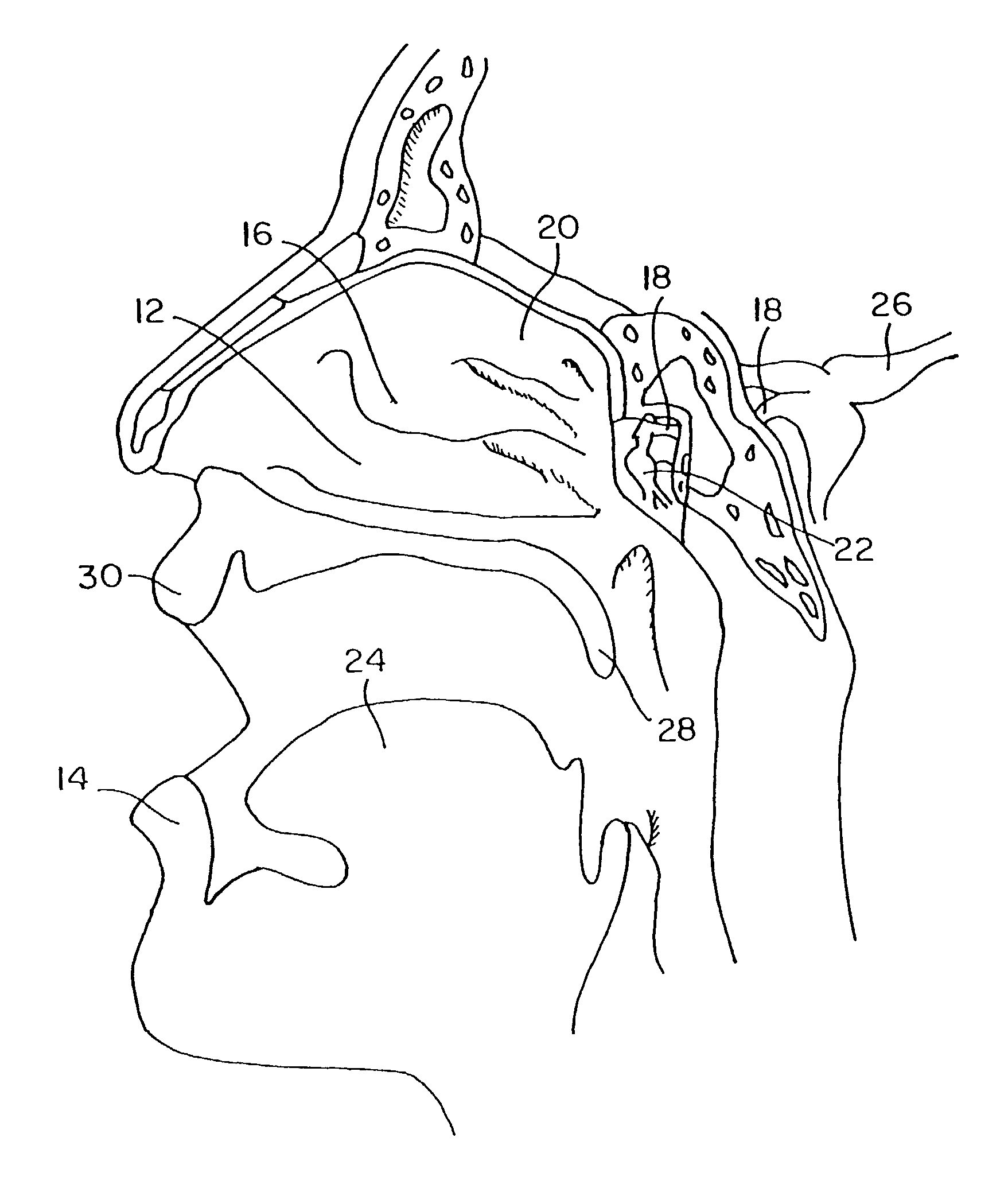 Method for directed intranasal administration of a composition