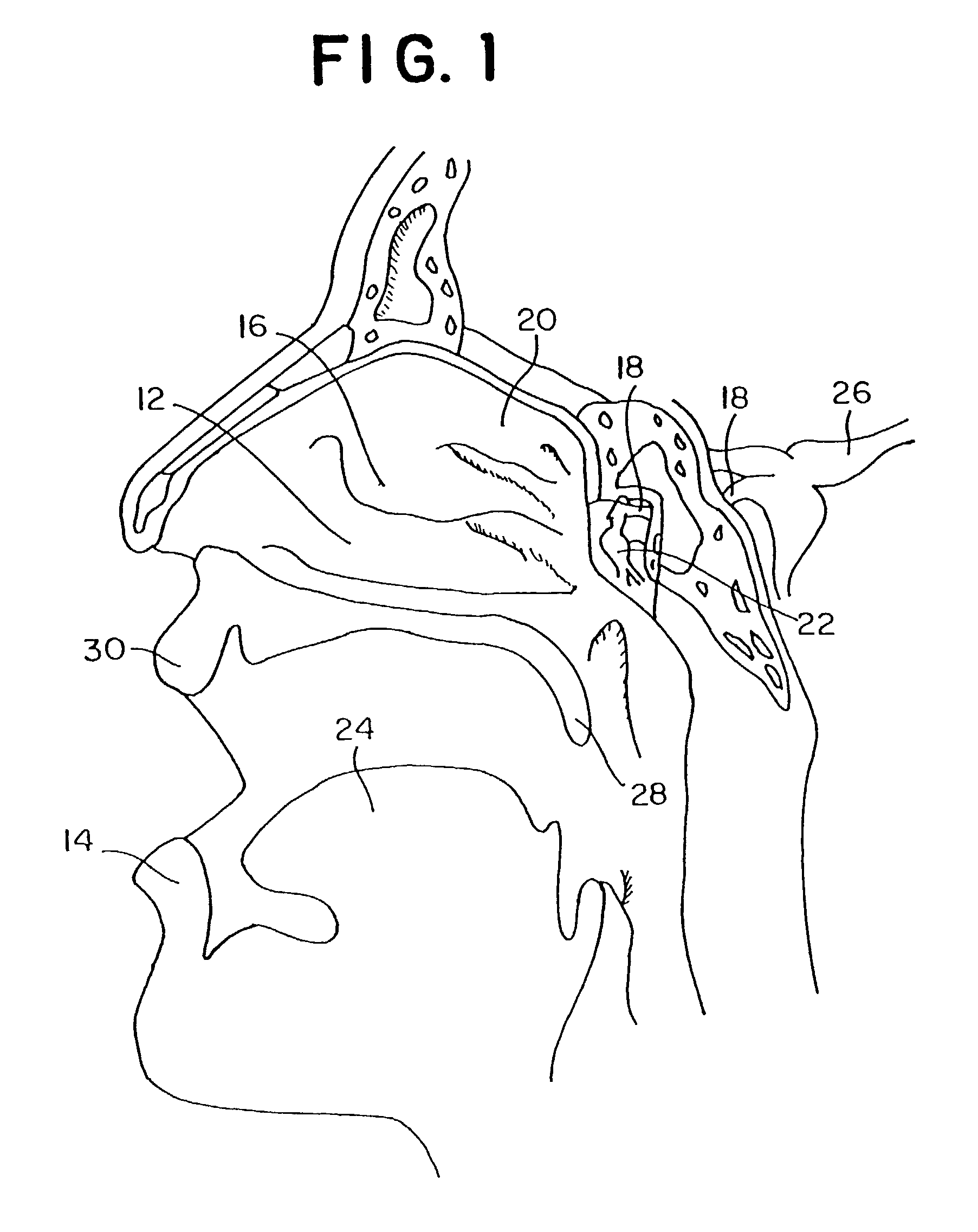 Method for directed intranasal administration of a composition