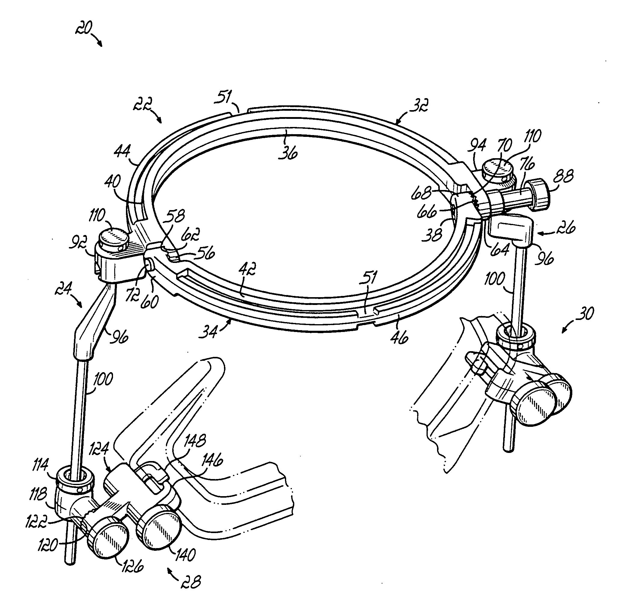 Radiolucent retractor and related components