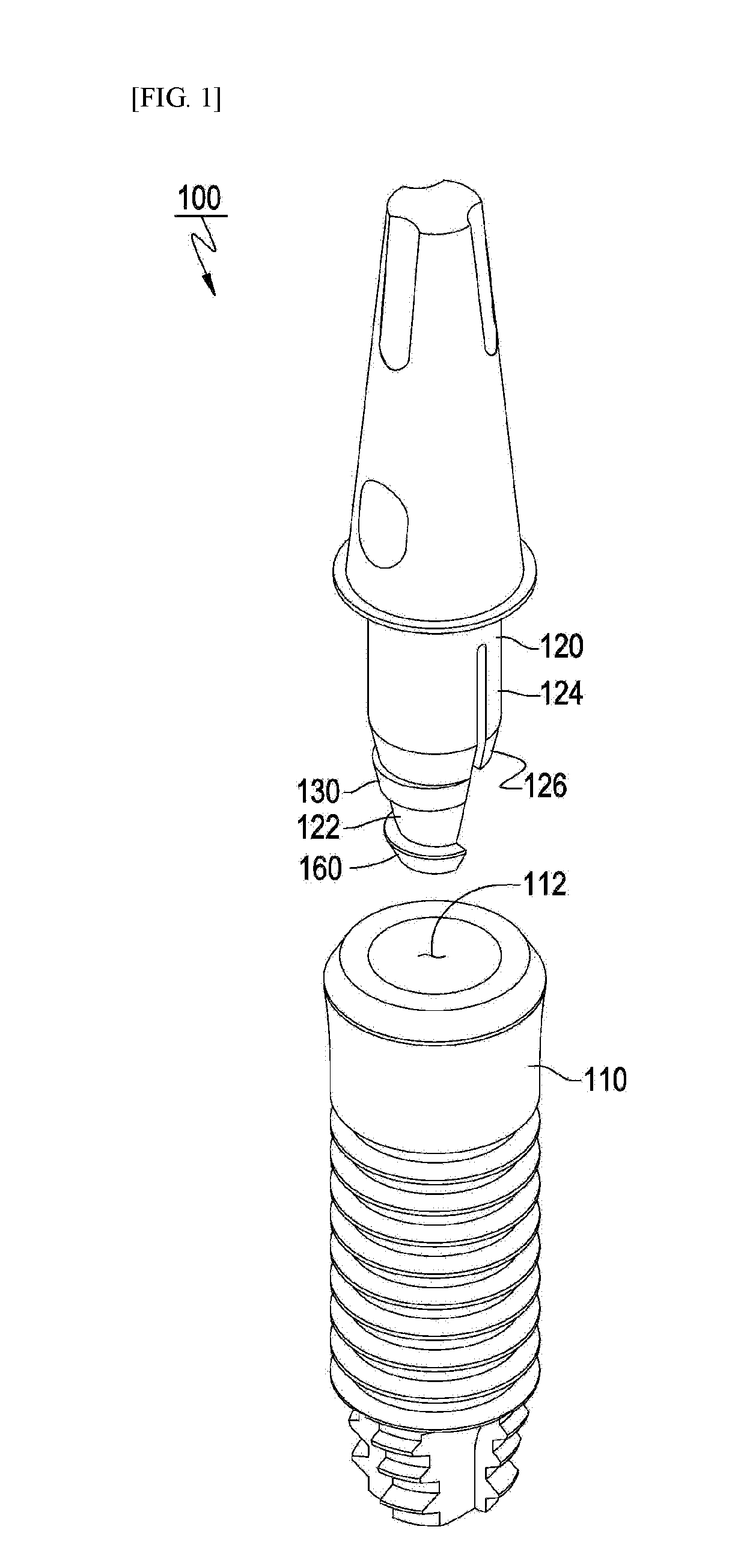 Dental implant